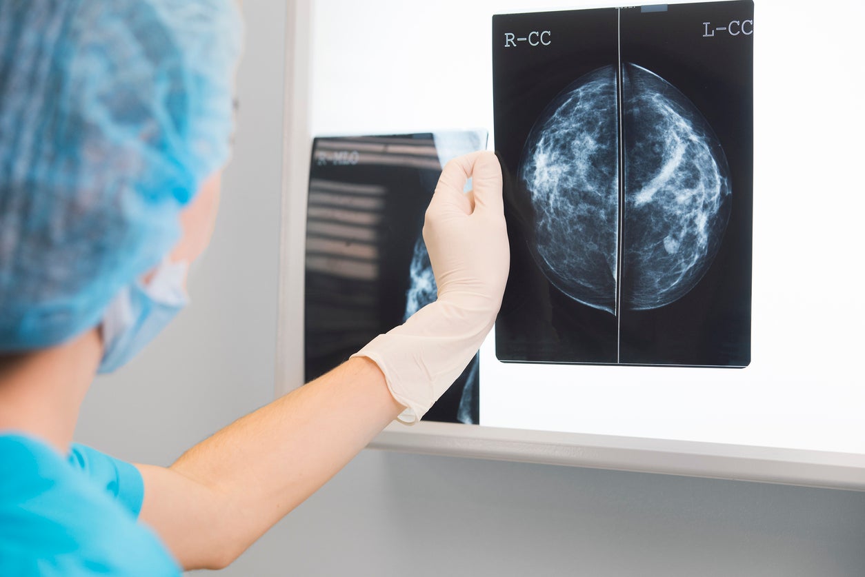 Florida Woman Was Told Nothing Showed Up On Her Mammogram. Now, She Is Getting $7m After Her Stage 4 Breast Cancer