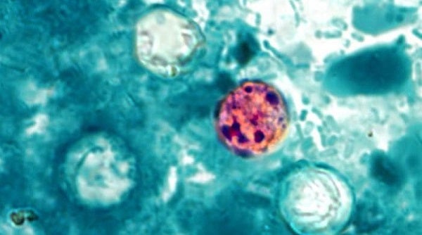 Cyclospora: What to know about the explosive diarrhoea parasite outbreak