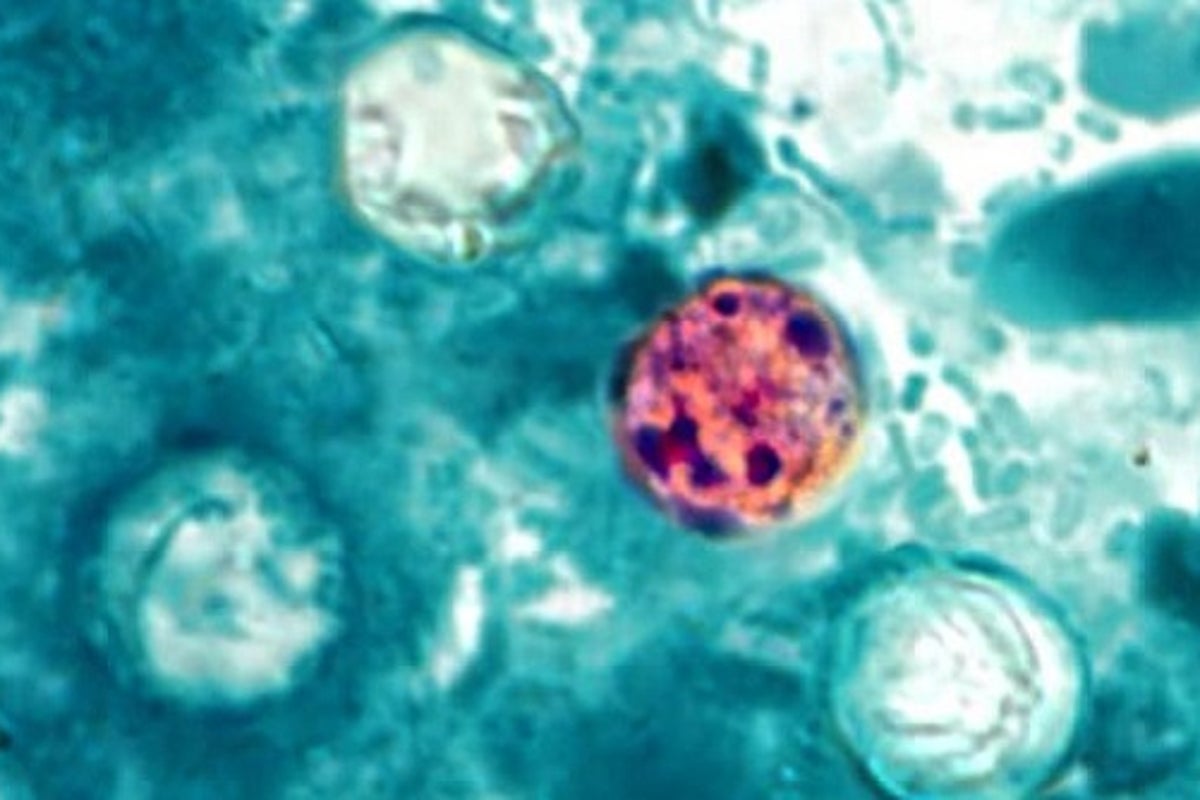 Cyclospora: What to know about the explosive diarrhoea parasite outbreak