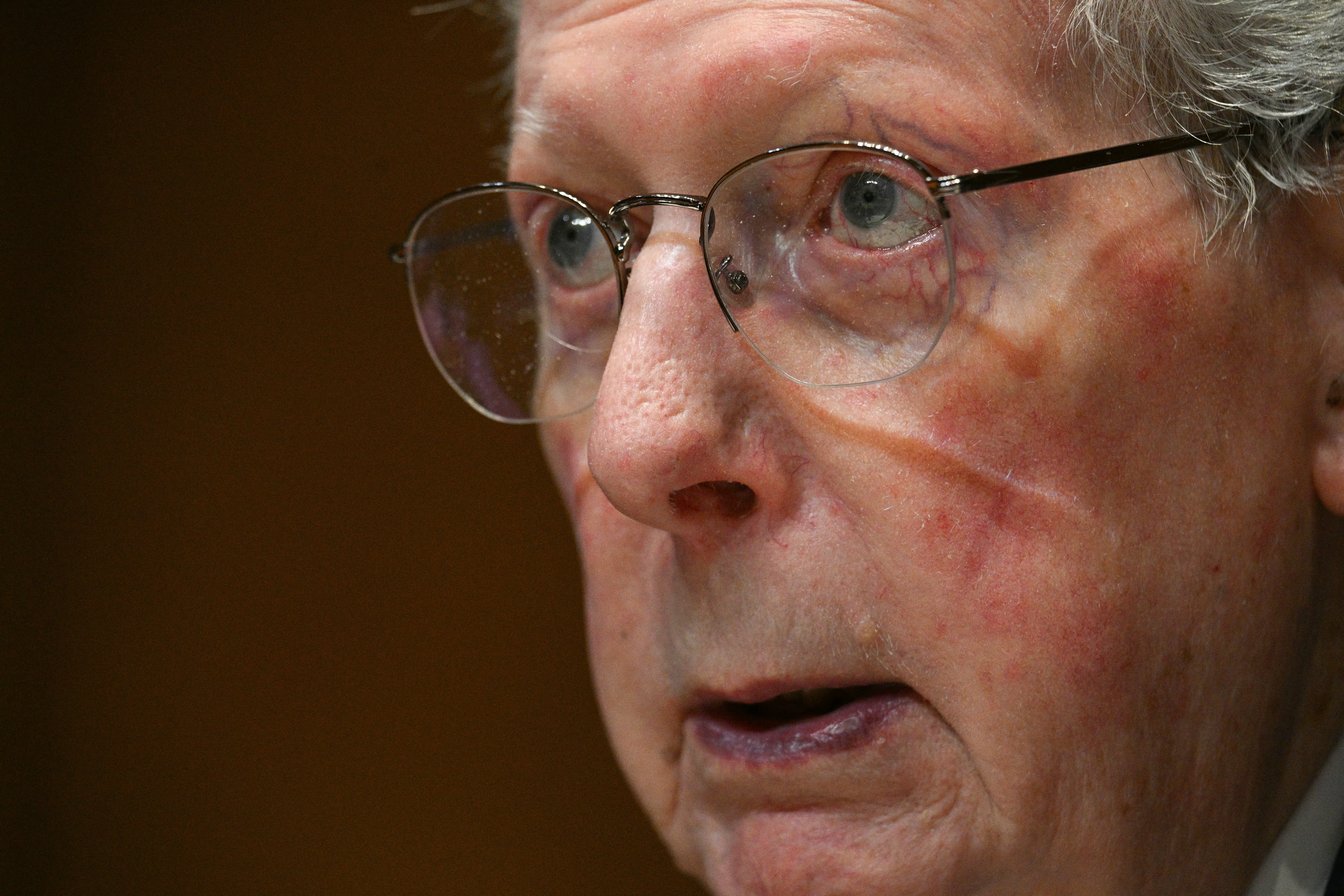 Mitch McConnell a no-show as Senate returns and questions about his extended absence remain a mystery Copy link Bookmark Go to comments Bookmark popover Removed from bookmarks Is Mitch McConnell returning to the Senate?
