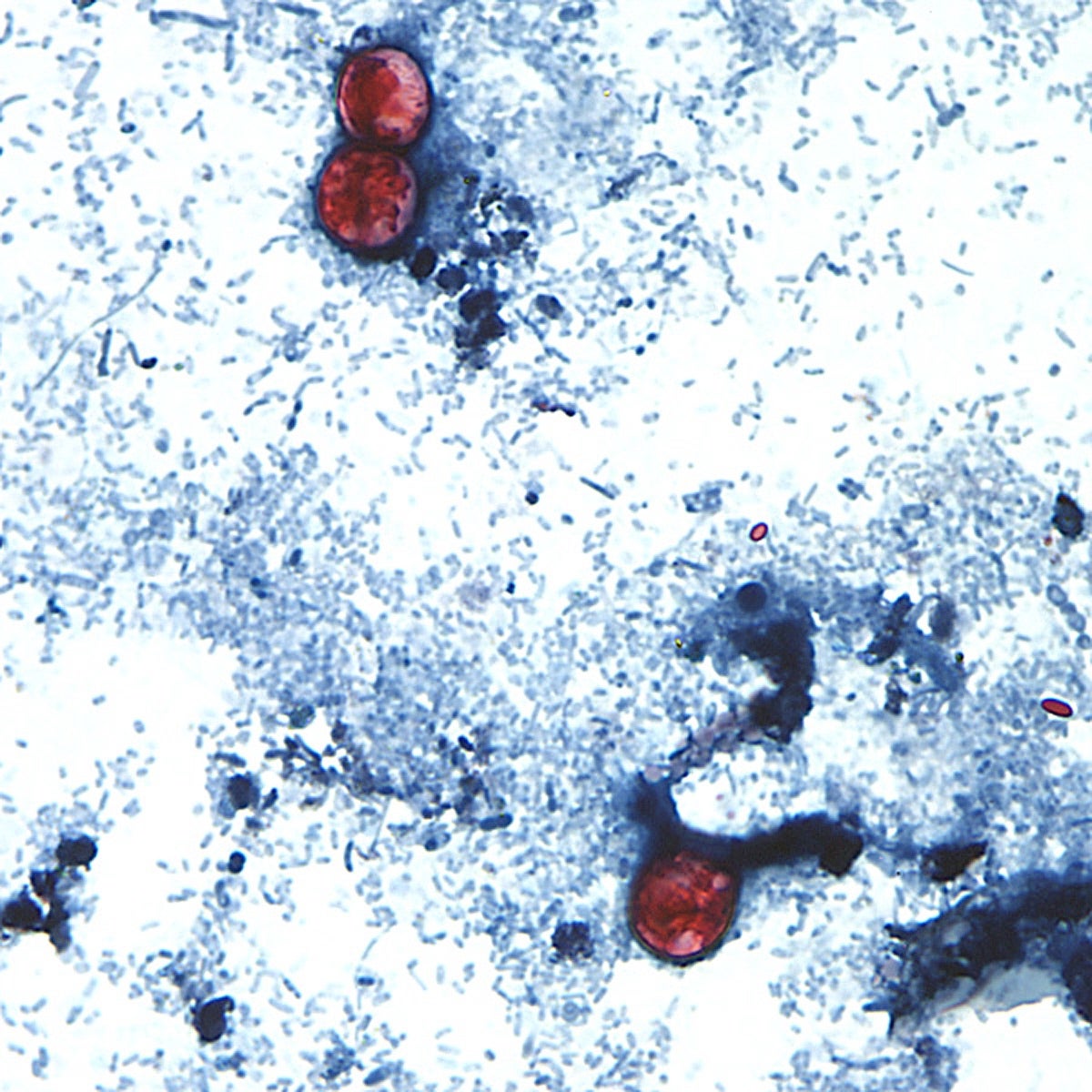 People go infected pinch cyclosporiasis, an intestinal illness, by consuming nutrient aliases h2o containing nan microscopic parasite cyclospora , pictured here.