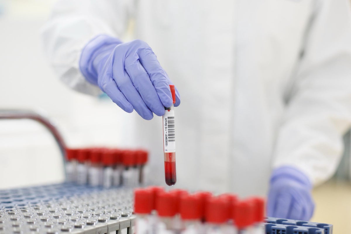 Sjogren’s syndrome: Groundbreaking blood test could detect ‘debilitating’ disease 10 years before symptoms emerge Sjogren’s syndrome: Groundbreaking blood test could detect ‘debilitating’ disease 10 years before symptoms emerge
