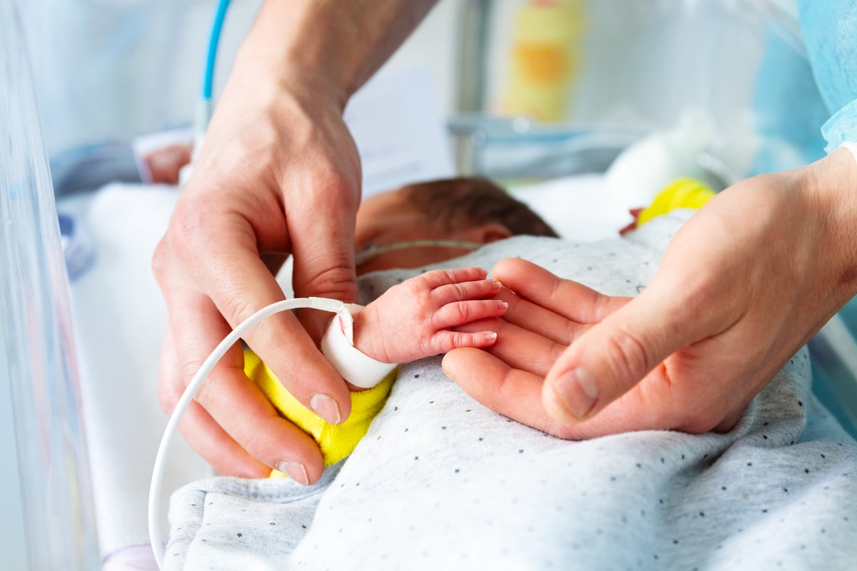 I’m a neonatologist. This is the health risk I worry about when NICU babies leave the hospital I’m a neonatologist. This is the health risk I worry about when NICU babies leave the hospital