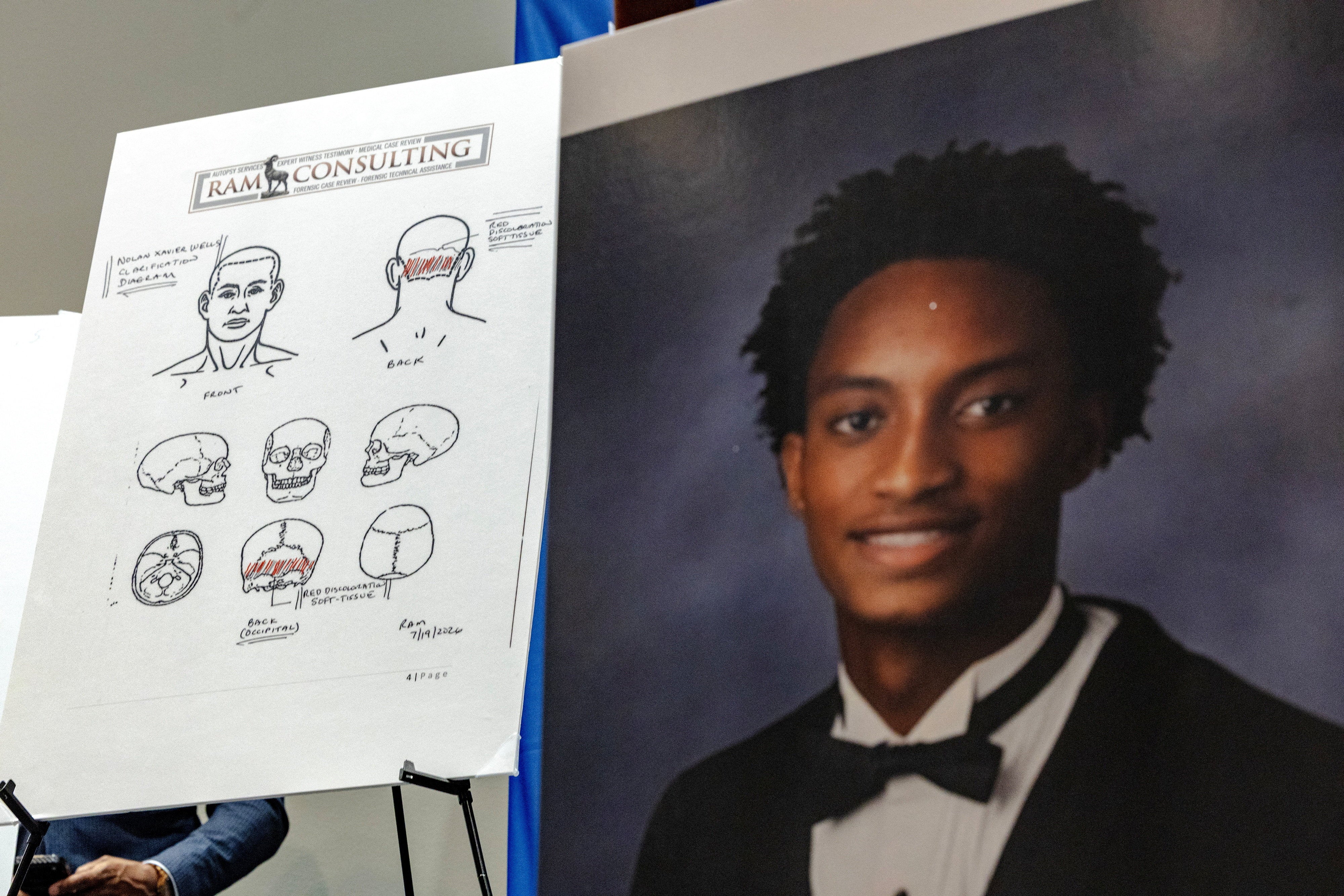 Diagrams depicting Nolan Wells' assemblage parts are displayed during nan announcement of nan results of an independent autopsy of nan young Black man whose assemblage was recovered connected an land disconnected nan seashore of Mississippi