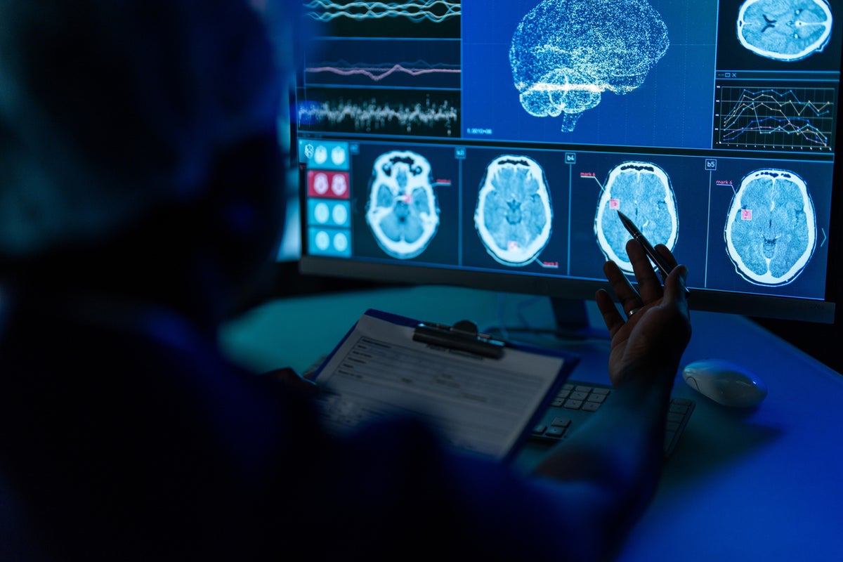 Breakthrough treatment possibilities for little-known brain condition that affects millions Breakthrough treatment possibilities for little-known brain condition that affects millions