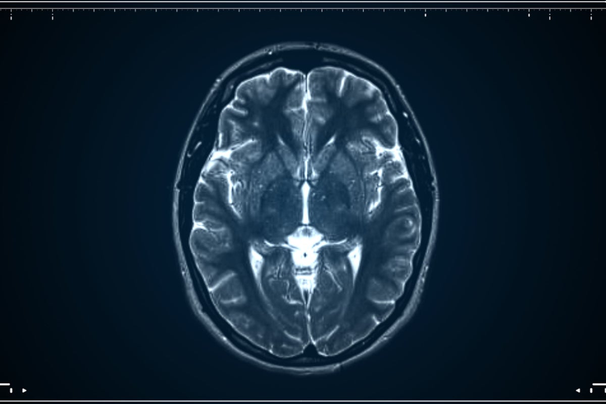 Scientists: Human brain actually two separate organs...