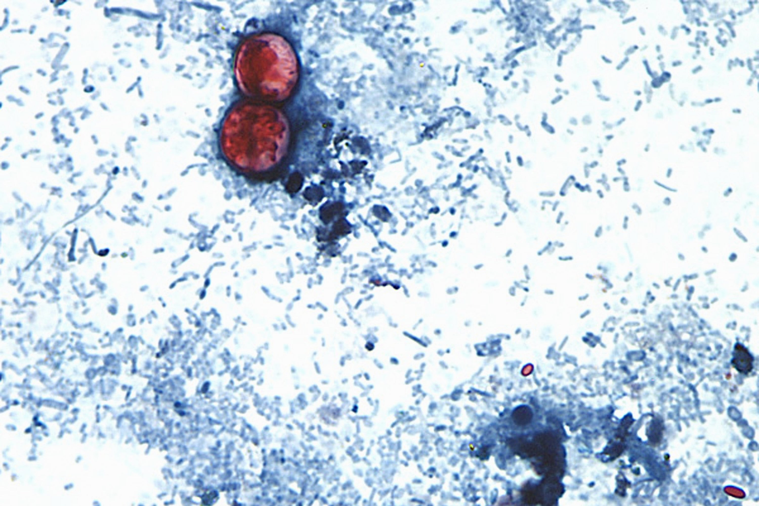The patient says that nan caller Cyclospora outbreak, which Salad and Go was not implicated, damaged assurance crossed nan industry