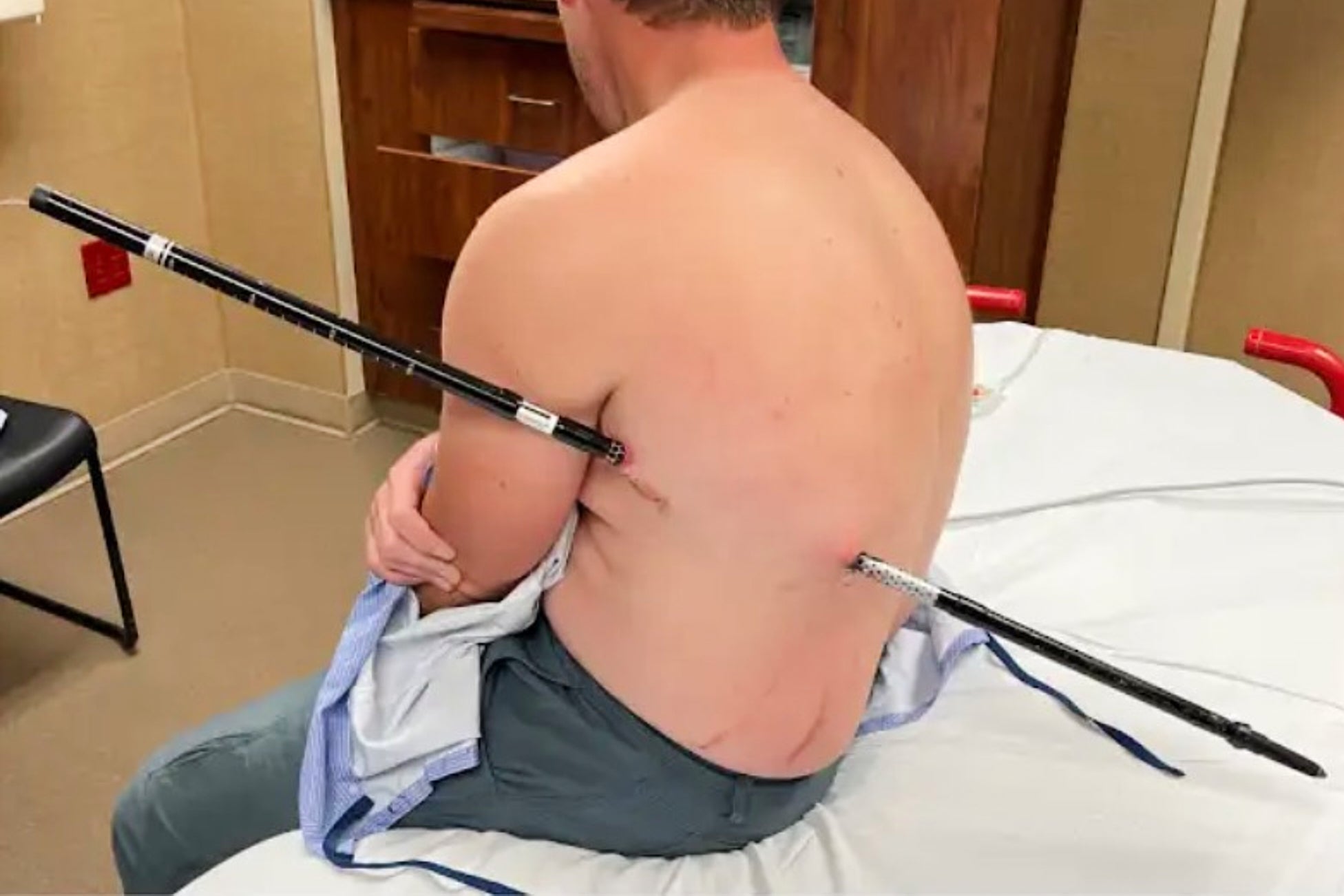 This photograph provided by David Cifaldi shows Cifaldi while he was being treated Monday, July 20, 2026, astatine St. Vincent Regional Hospital successful Billings