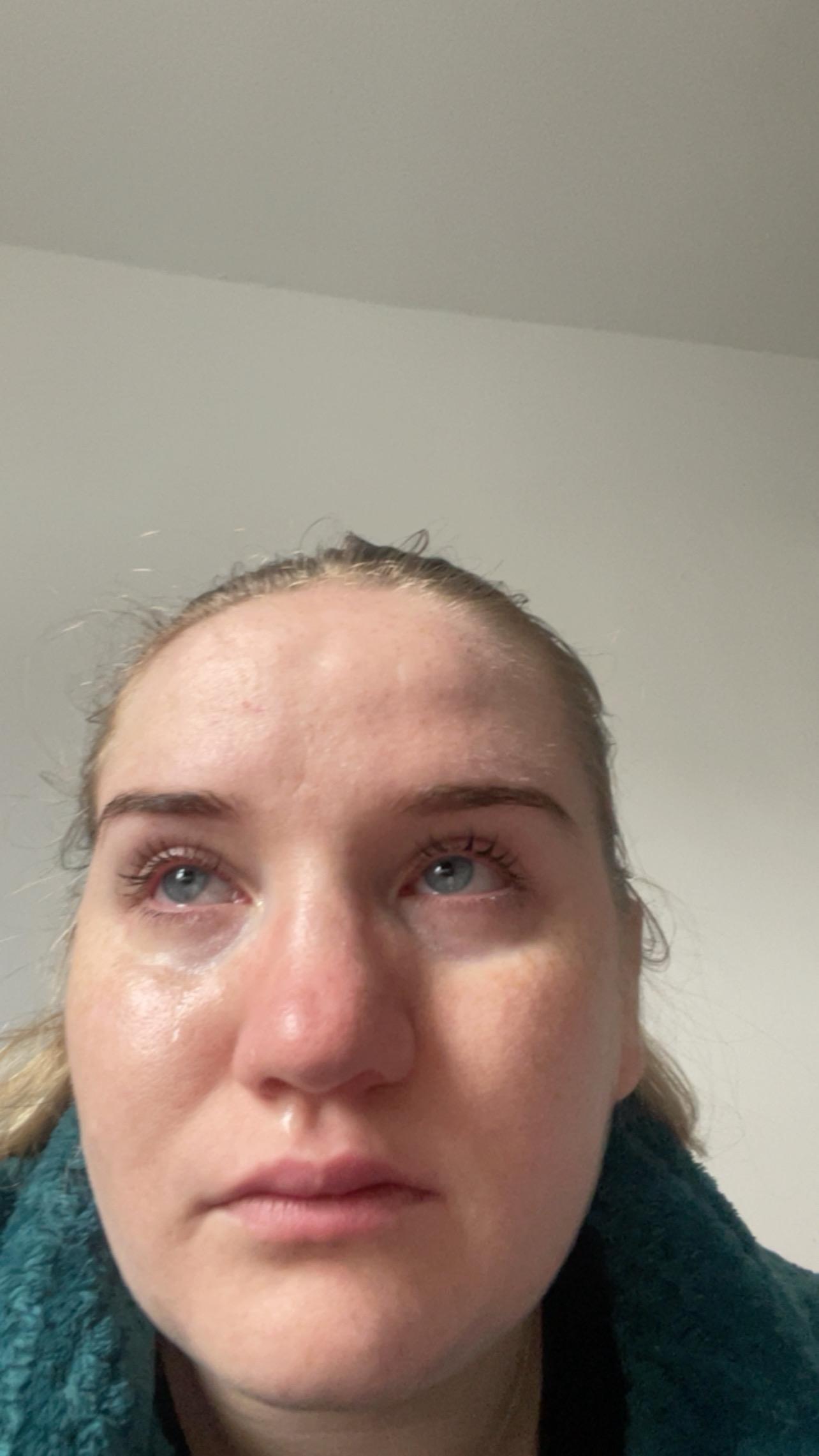 ‘I’ve missed out on my entire adulthood so far,’ Phoebe said
