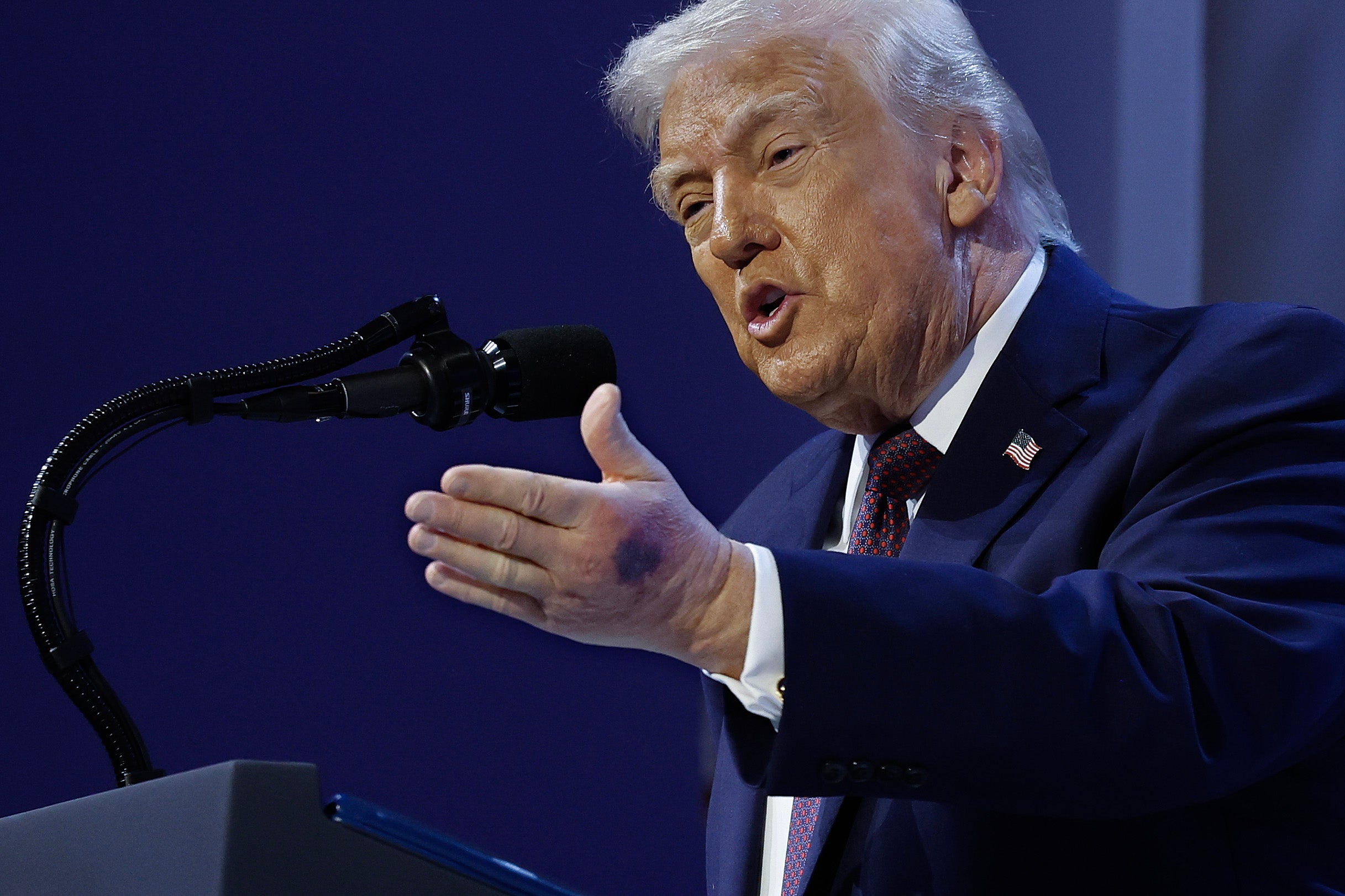 Dick Cheney’s Doc Says Americans ‘deserve Answers’ About The Mysterious Ailments Impacting Trump