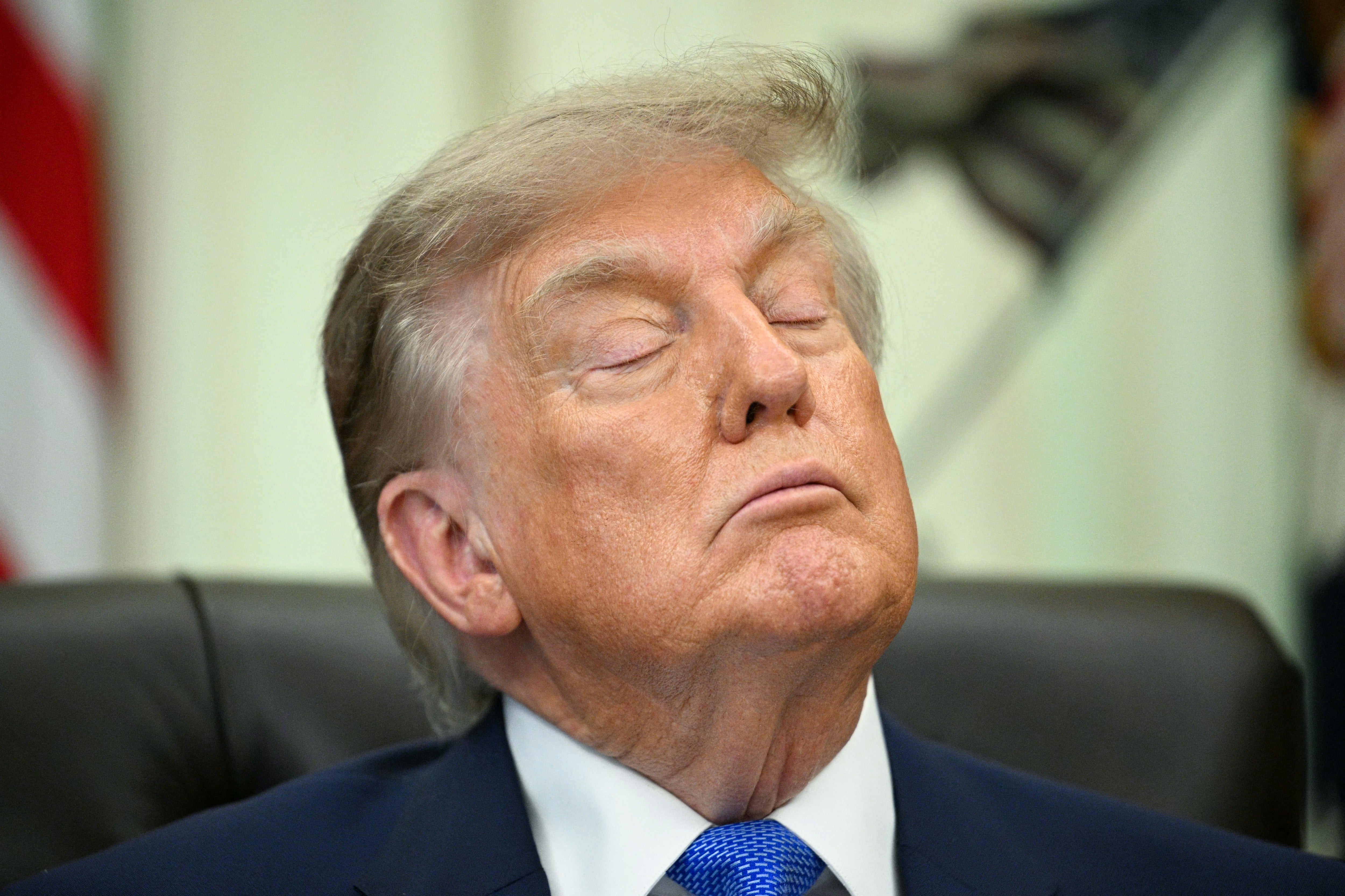 Trump has faced increasing scrutiny complete his manus bruising, limb swelling and moments wherever he appears to motion disconnected connected camera