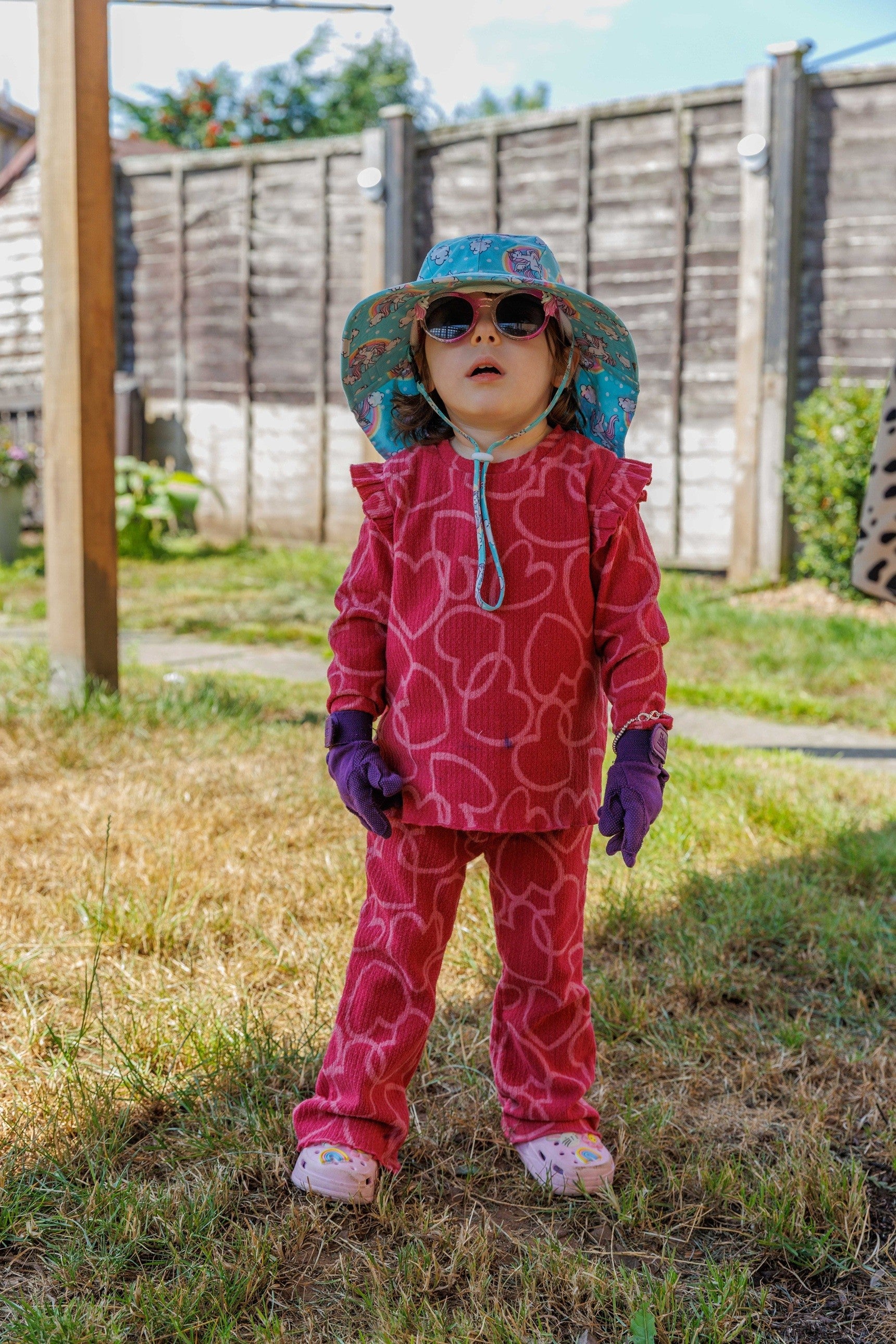 <p>Mollie Murray of Montrose is the only child in the UK known to have her specific variant of xeroderma pigmentosum (XP), making her skin extremely sensitive to ultraviolet light</p>