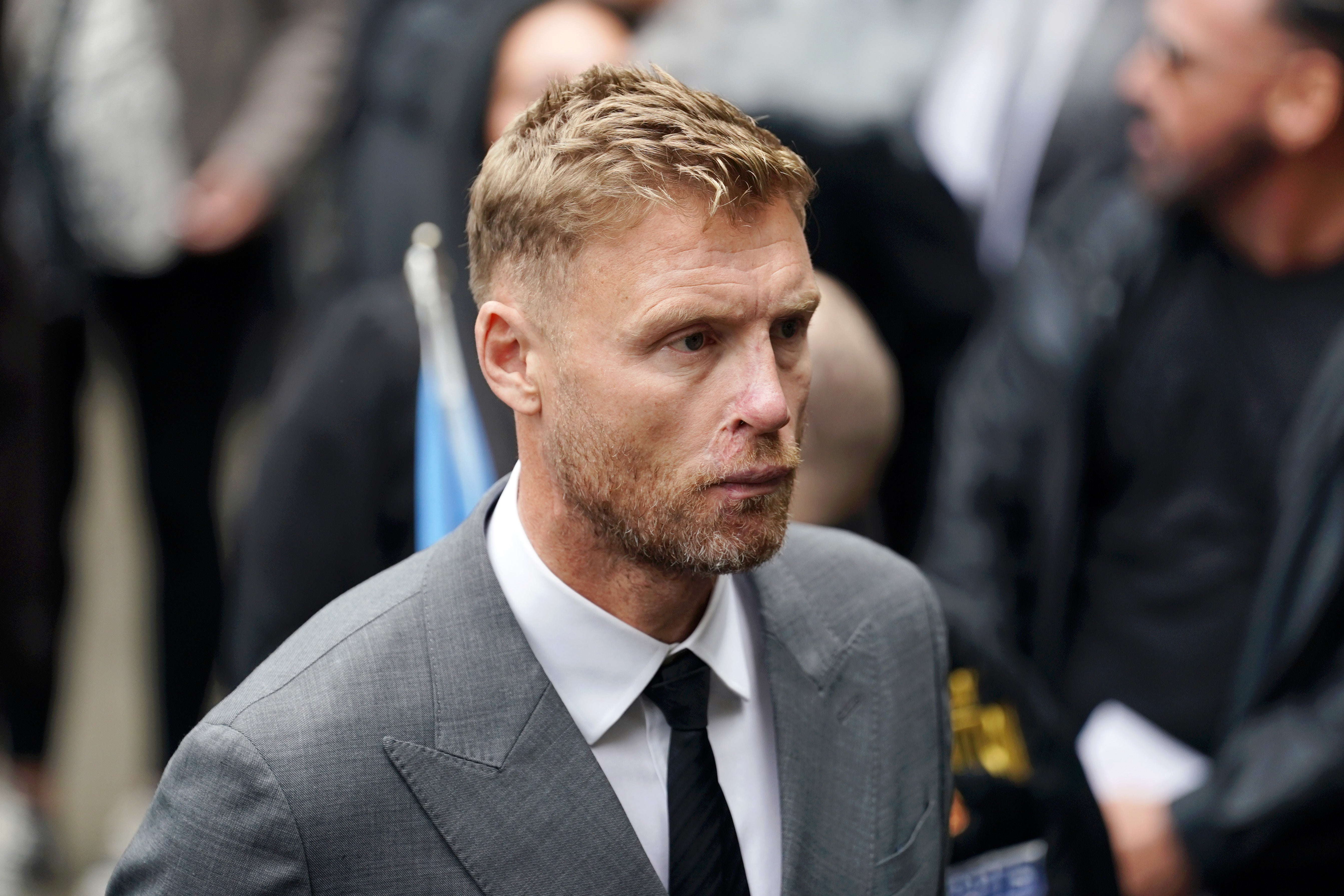 Freddie Flintoff suffered serious facial injuries in a crash while filming