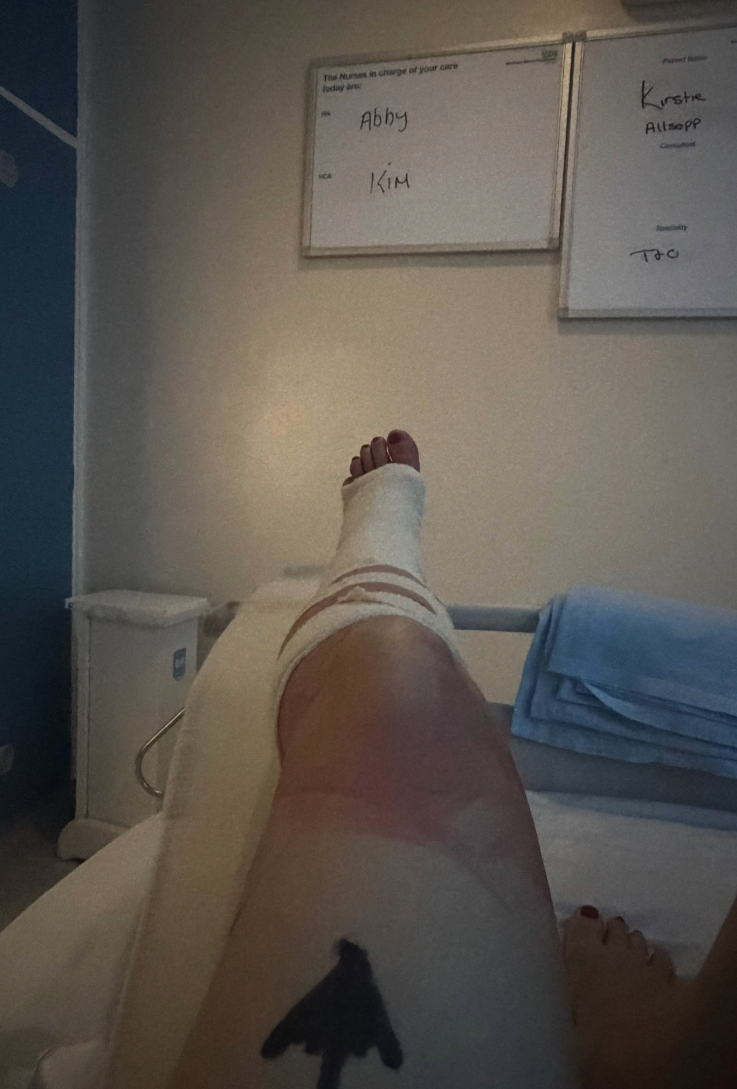 Allsopp suffered a leg injury after the fall