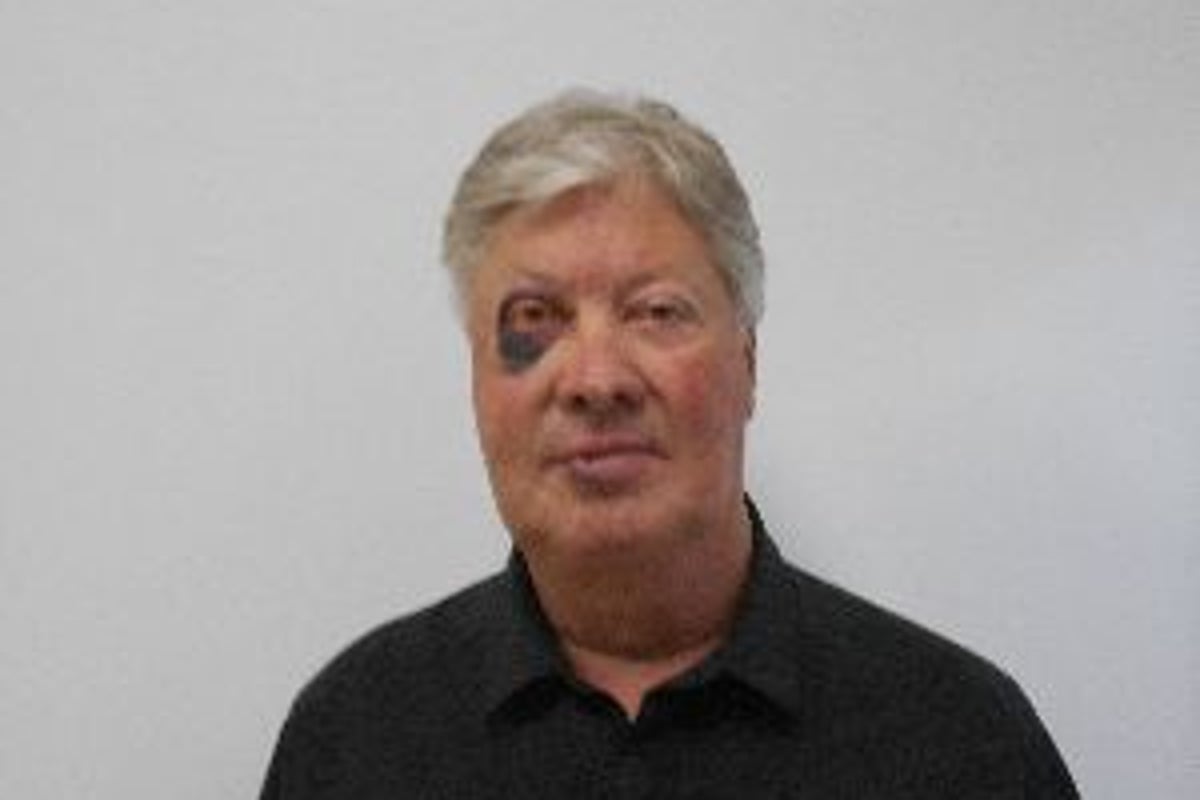 Disgraced former megachurch pastor Robert Morris seen with black eye in ...