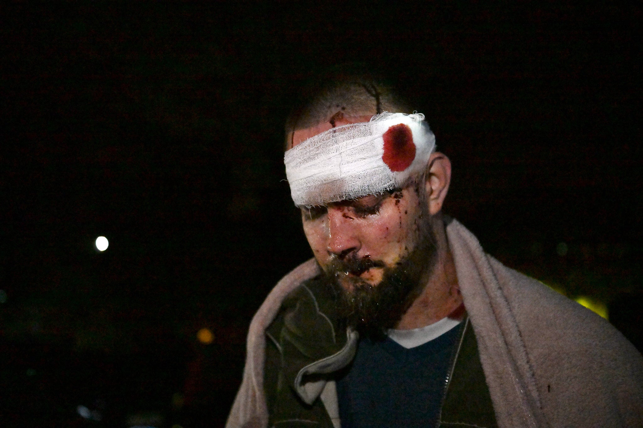 Ukraine-Russia war latest: Moscow committed crimes against humanity in ...