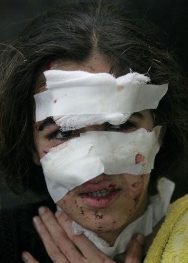 An injured Iraqi girl waits for treatment in a Baghdad hospital