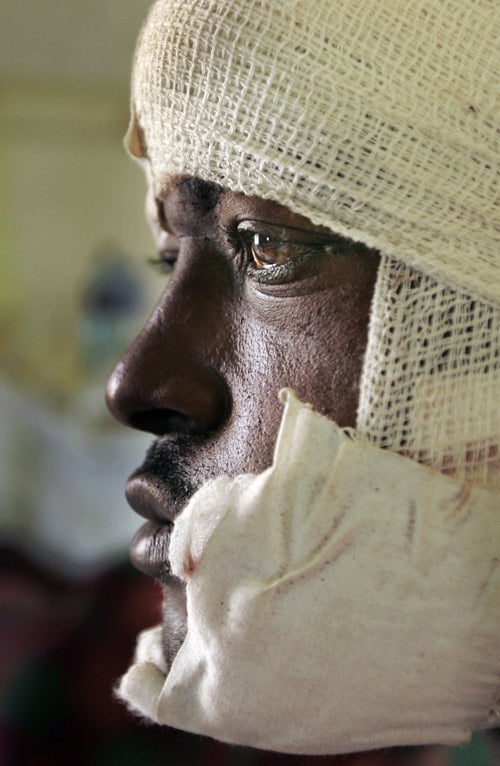 Benadi Mbawa, 32, who was attacked by men with machetes, sits bandaged on a hospital bed, in Nakuru