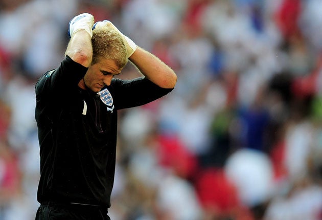 Hart is now England's only senior goalkeeper