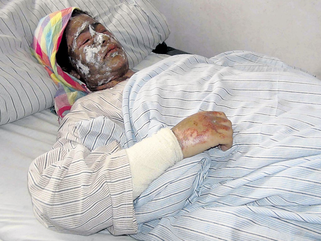 The Afghan family victims, aged 17, 14 and eight, were disfigured for life for refusing to wed a warlord