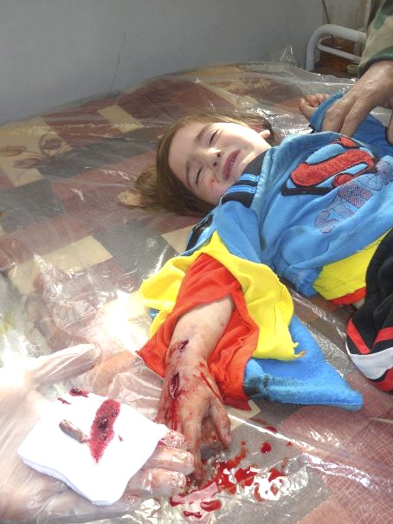 A doctor at a makeshift hospital displays a bullet removed from the hand of a young girl wounded during an attack at the Khalidiya neighbourhood in Homs