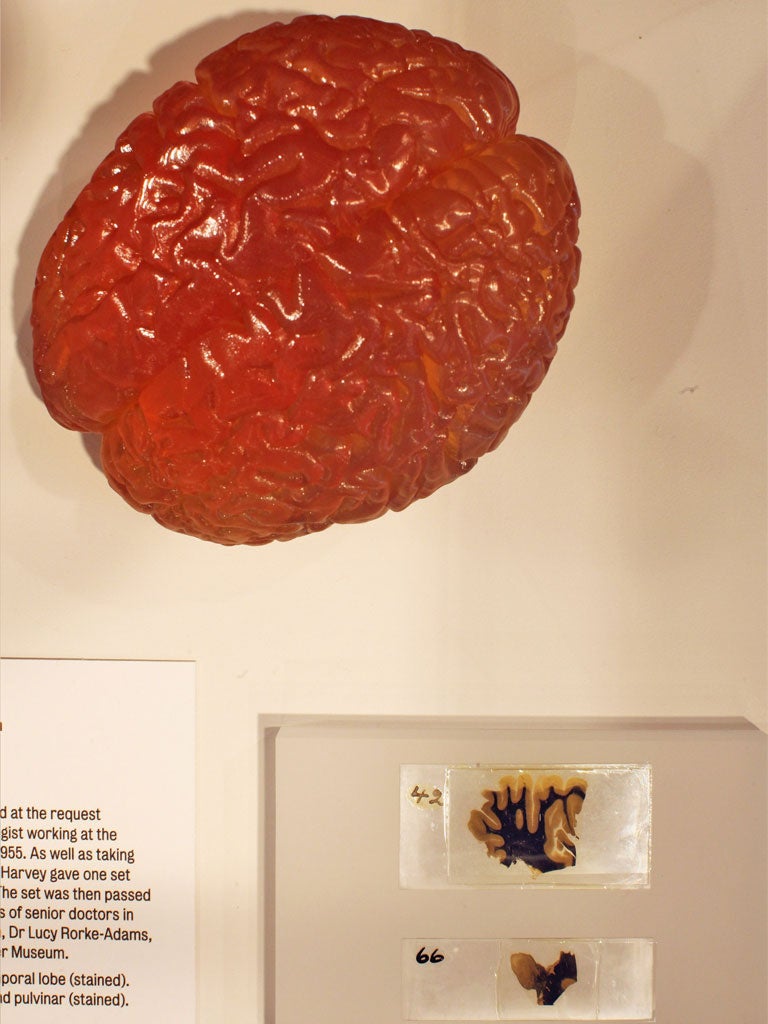 Two slices of Albert Einstein's brain and a model, above, are displayed at the Wellcome Trust's 'Brains: The Mind As Matter' exhibition