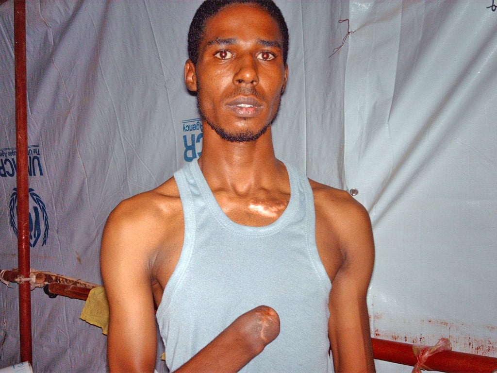 Majdi Suleiman Omar lost a hand during the fighting in Misrata