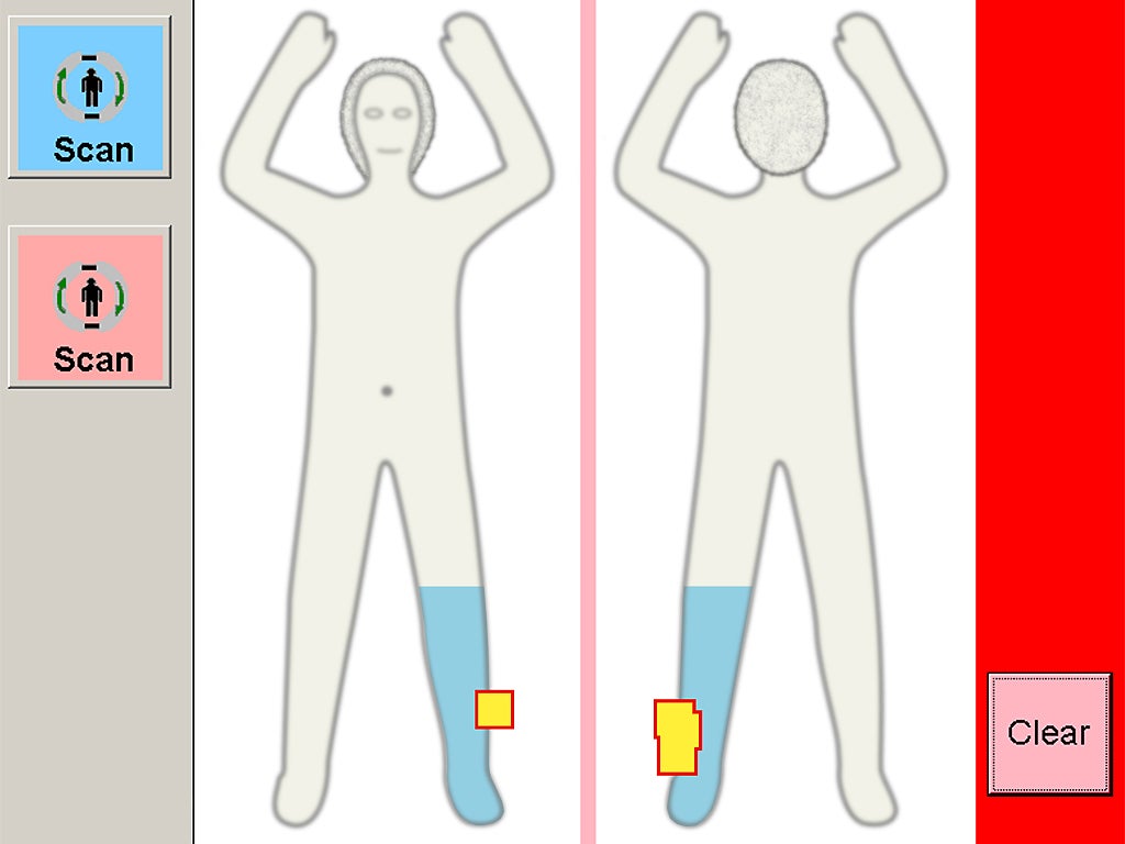 The 'no embarrassment' scanner image highlights something for security personnel to check