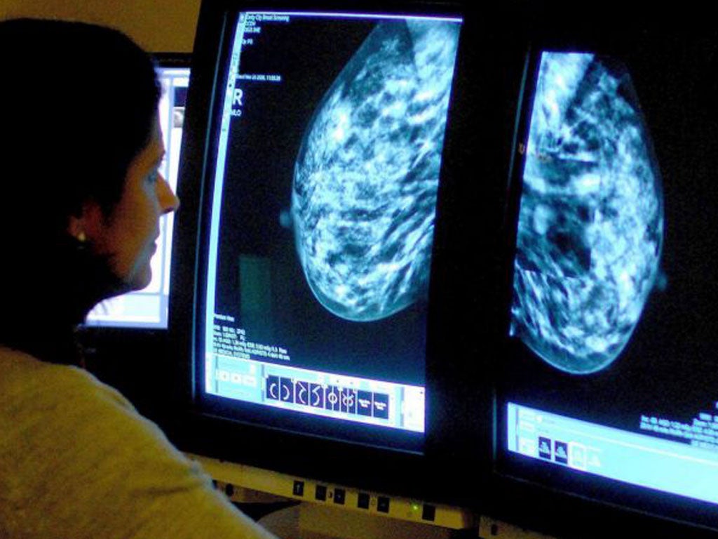 Breast cancer screening leads to thousands of women undergoing unnecessary treatment despite saving lives, according to an independent review