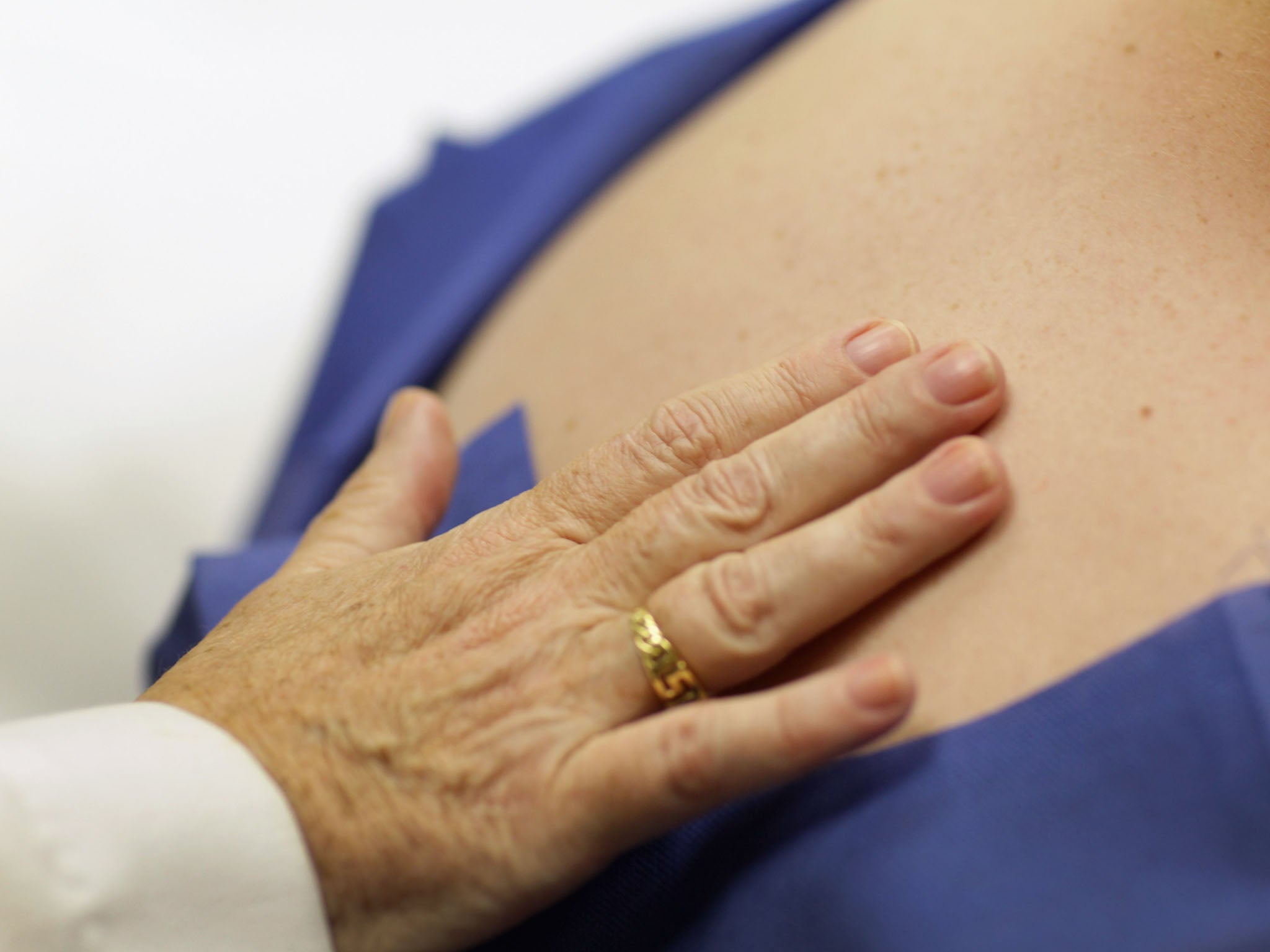 A doctor examines a woman for signs of skin cancer