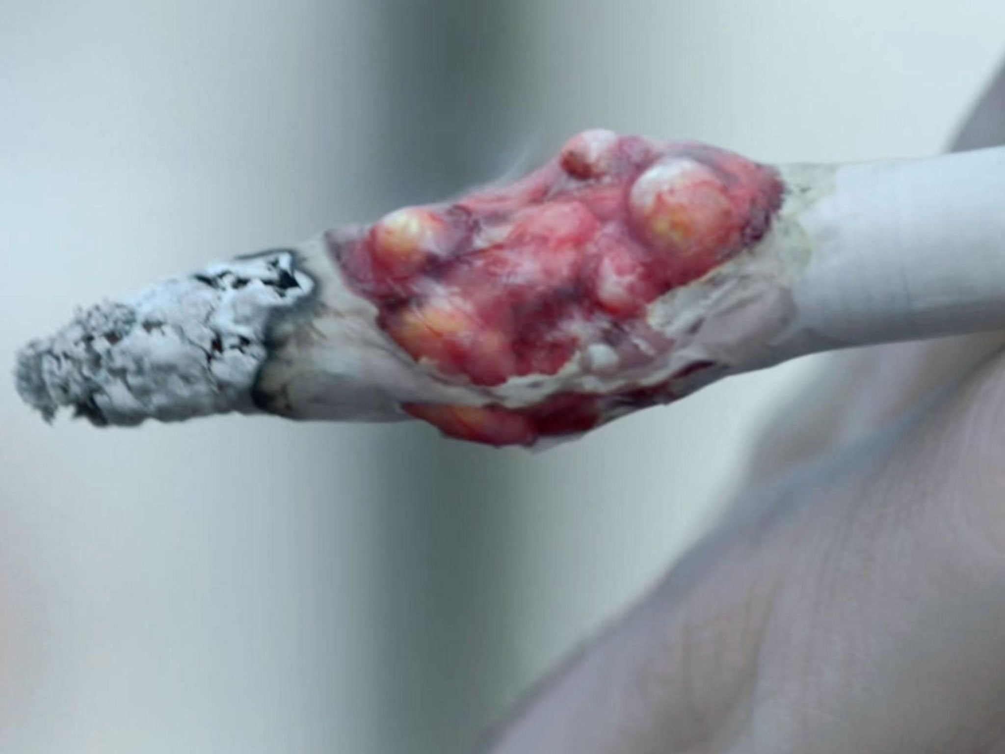 A graphic image from the 2007 Department of Health anti-smoking campaign. Kerry McCarthy wants similar ads directed at meat-eaters to warn of the impact to animal welfare