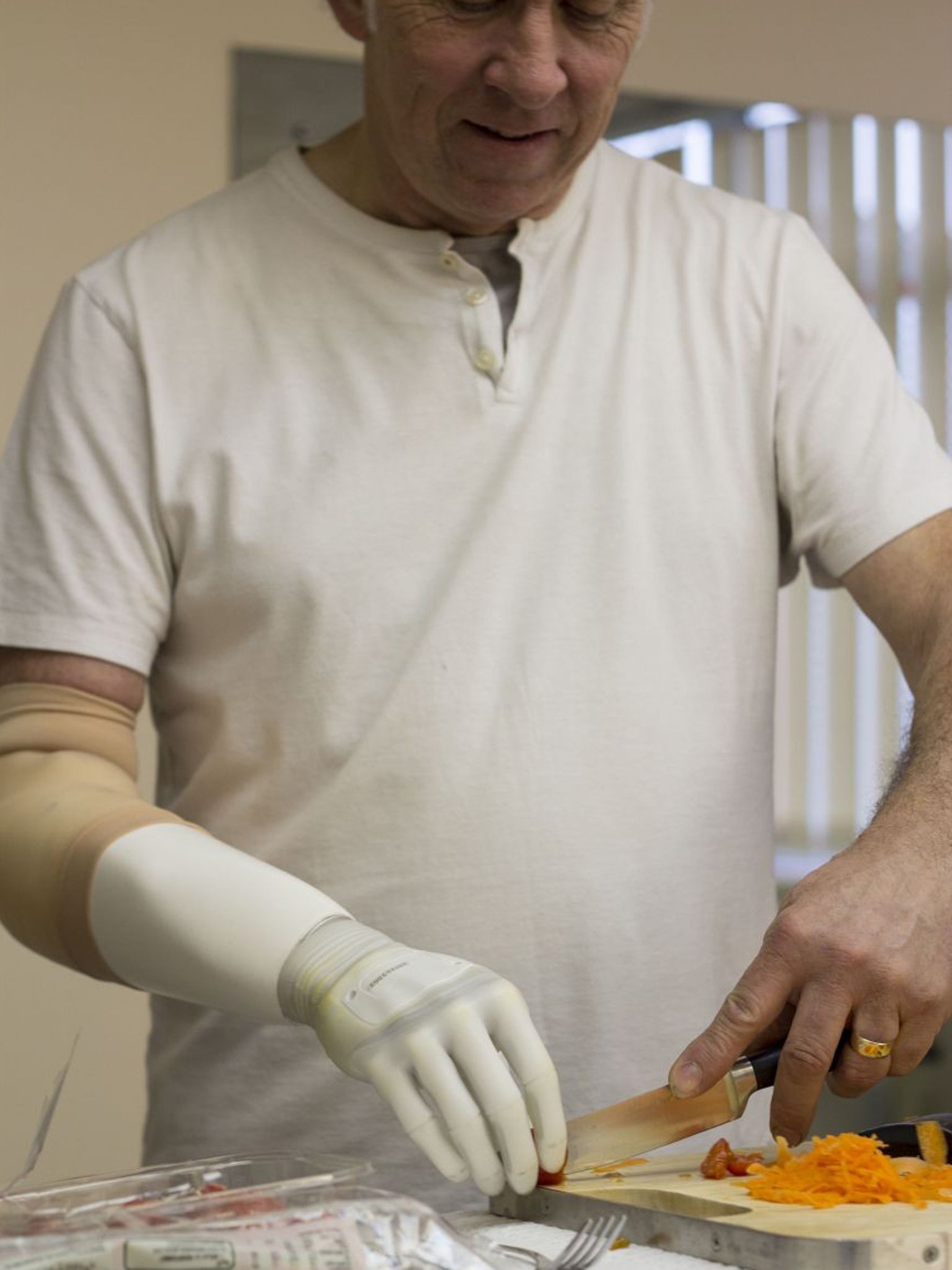 Christopher Taylor using his £47,000 Michelangelo hand to chop tomatoes