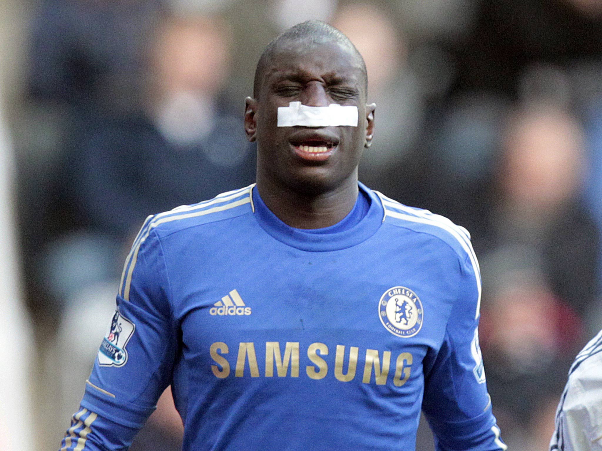 Demba Ba hurt his nose against Newcastle