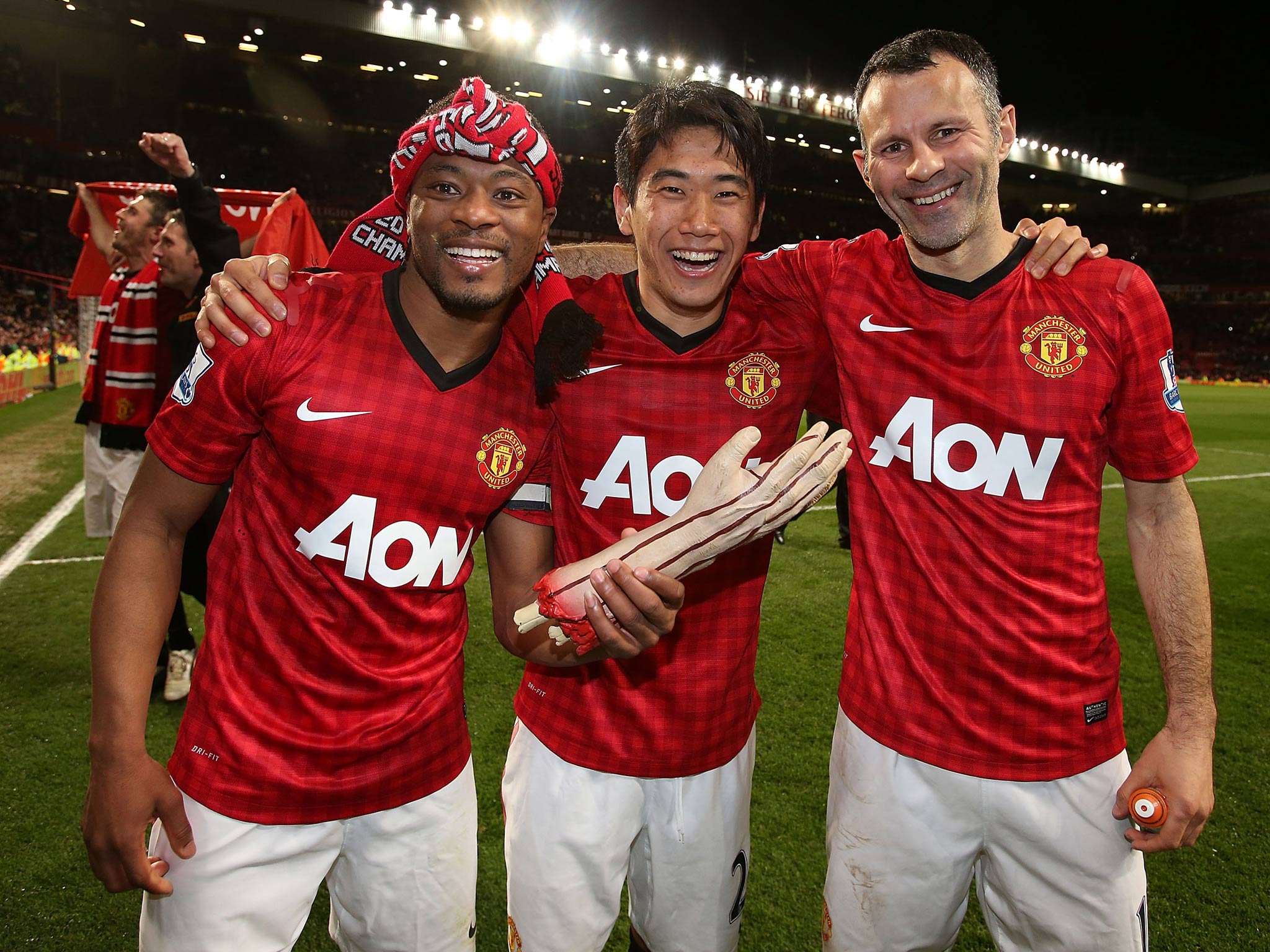 Patrice Evra poses with the fake arm at Old Trafford