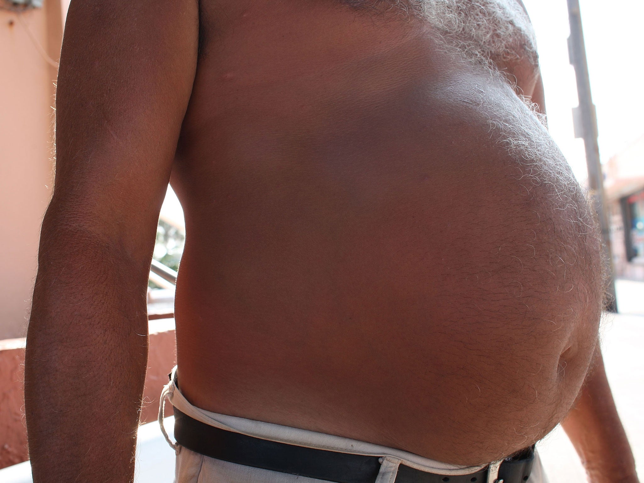 A shirtless man stands outside August 31, 2007 in Hollywood, Florida. The recent F as in Fat: How Obesity Policies are Failing in America, 2007 report from the Trust for America's Health shows that adult obesity rates rose in 31 states last year, according to the fourth annual report.