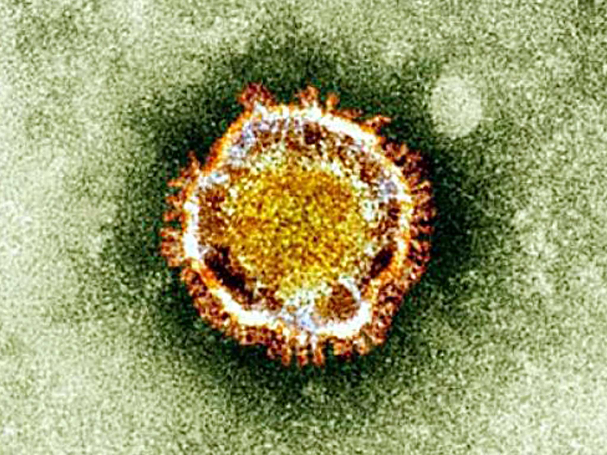 The Coronavirus seen under an electron miscroscope