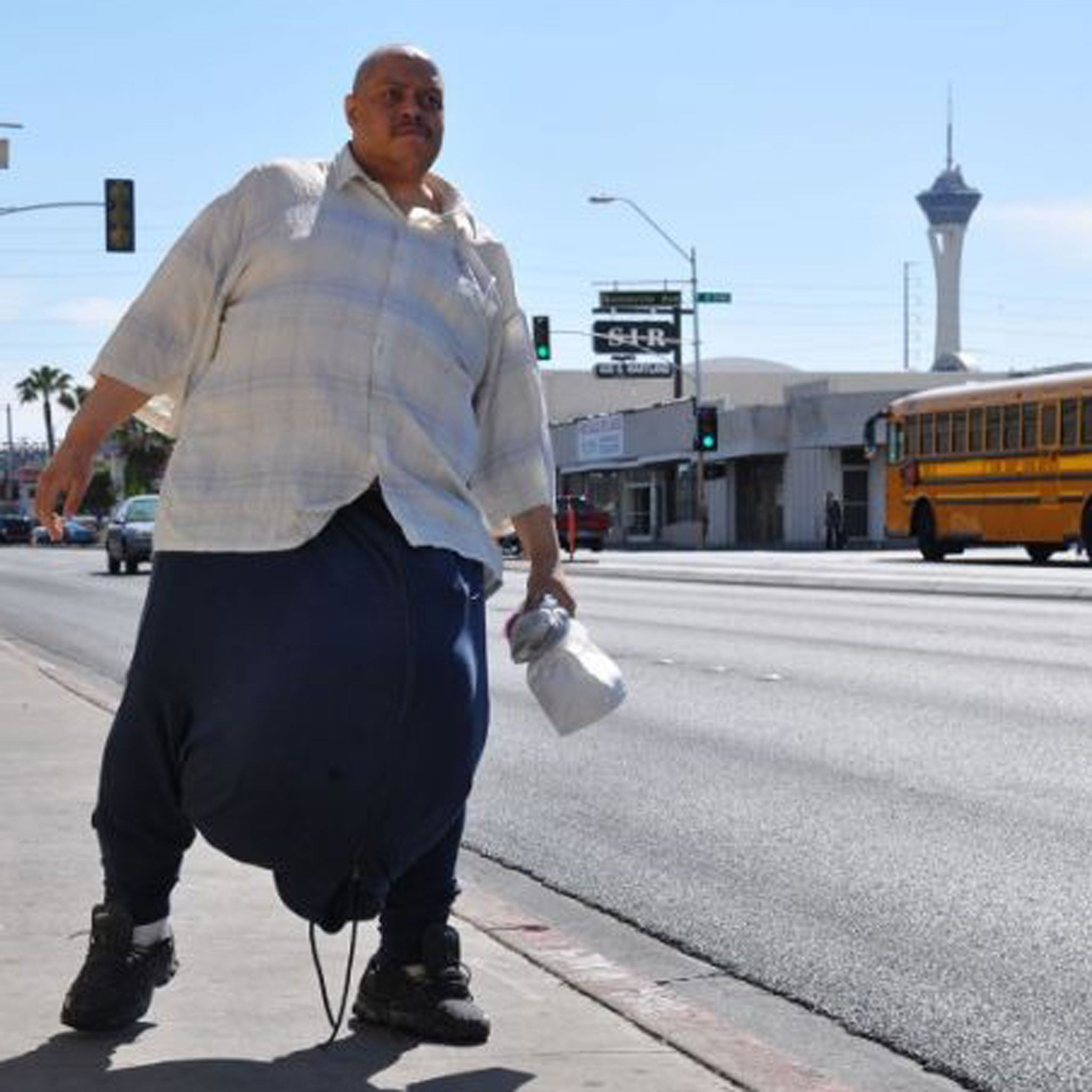 The Man with the 10 Stone Testicles