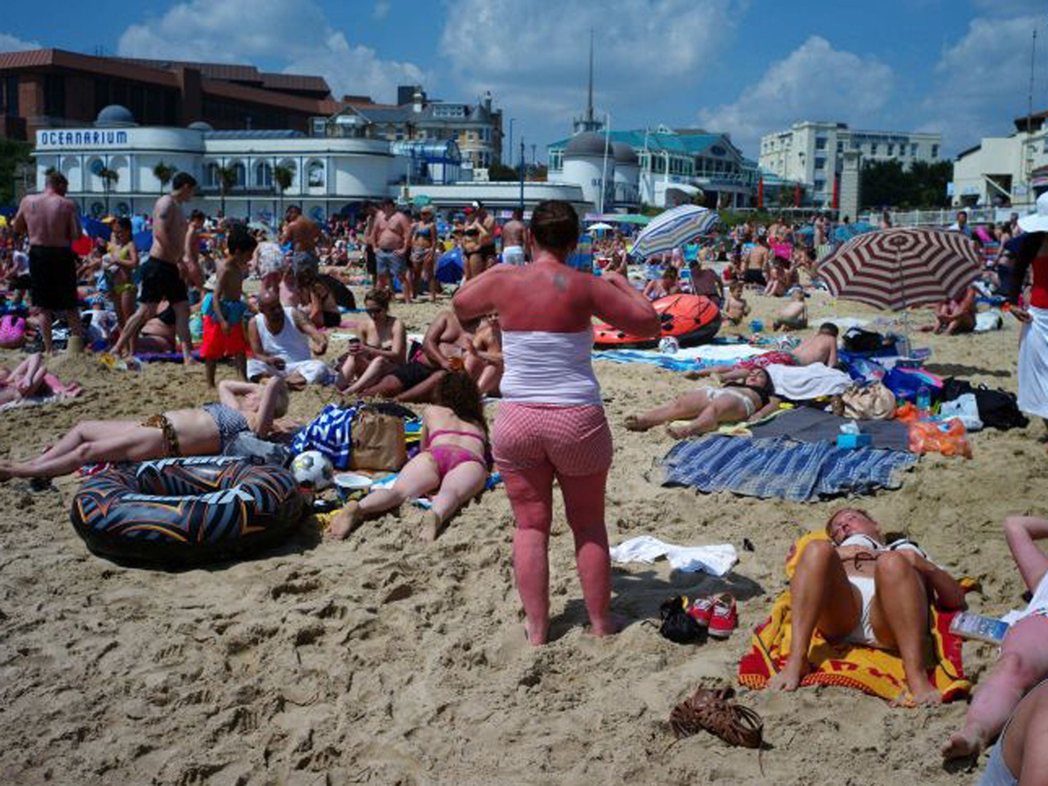 Sunburn can increase the risk of developing melanoma, the deadly form of skin cancer