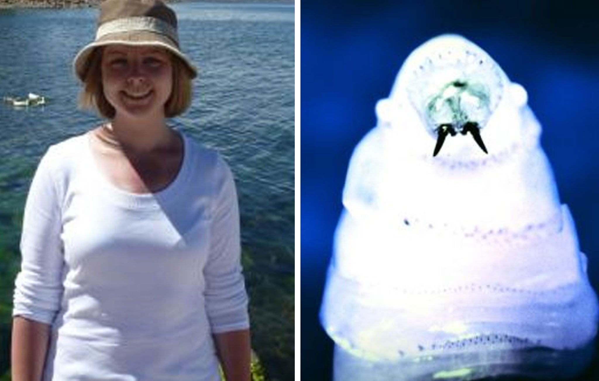 A British woman has described in detail the moment she discovered headaches and scratching sounds in her head were caused by flesh-eating maggots.