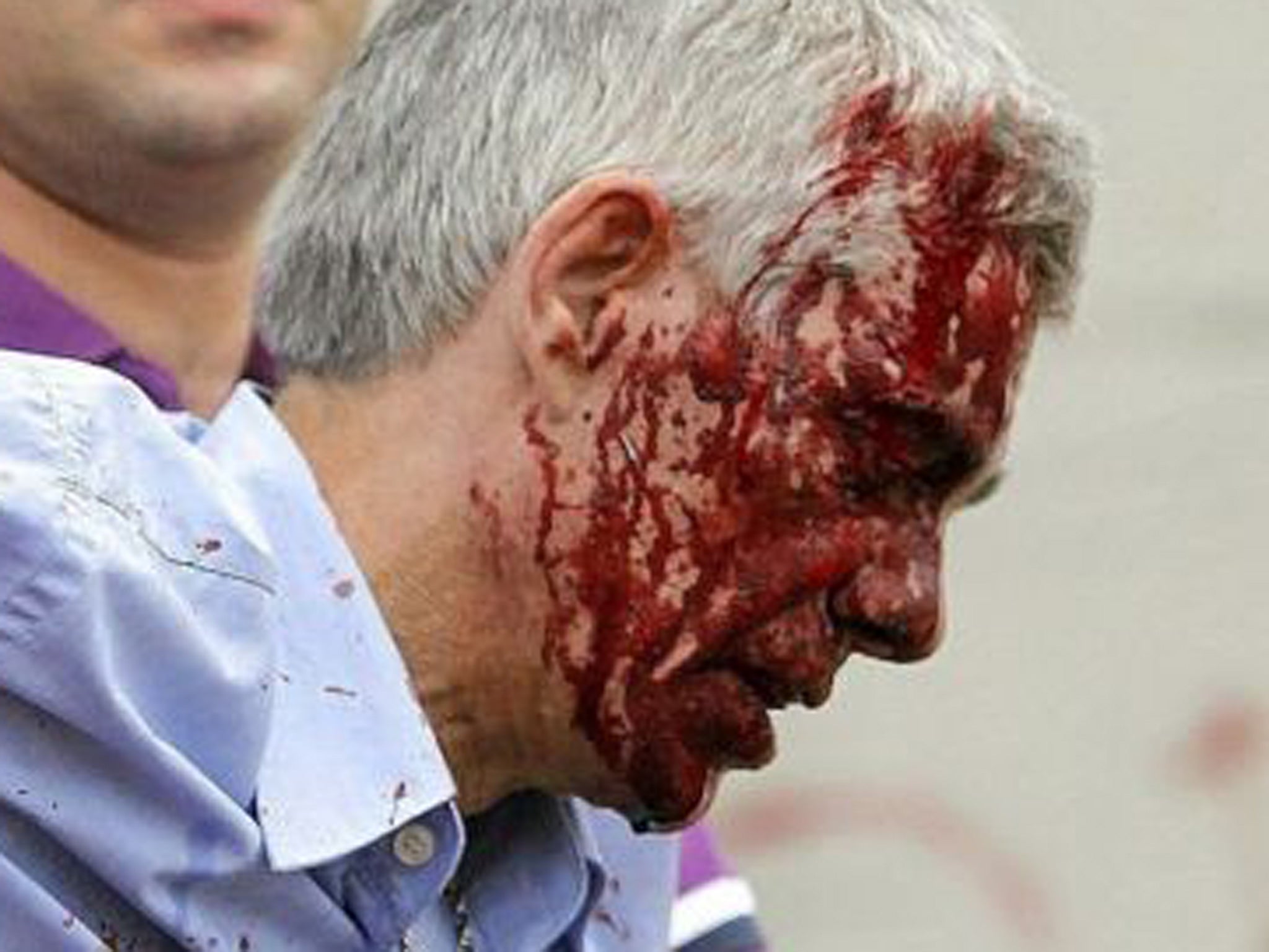Francisco Jose Garzon, driver of the derailed train, being aided just after the accident on 24 July, in Santiago de Compostela, Spain
