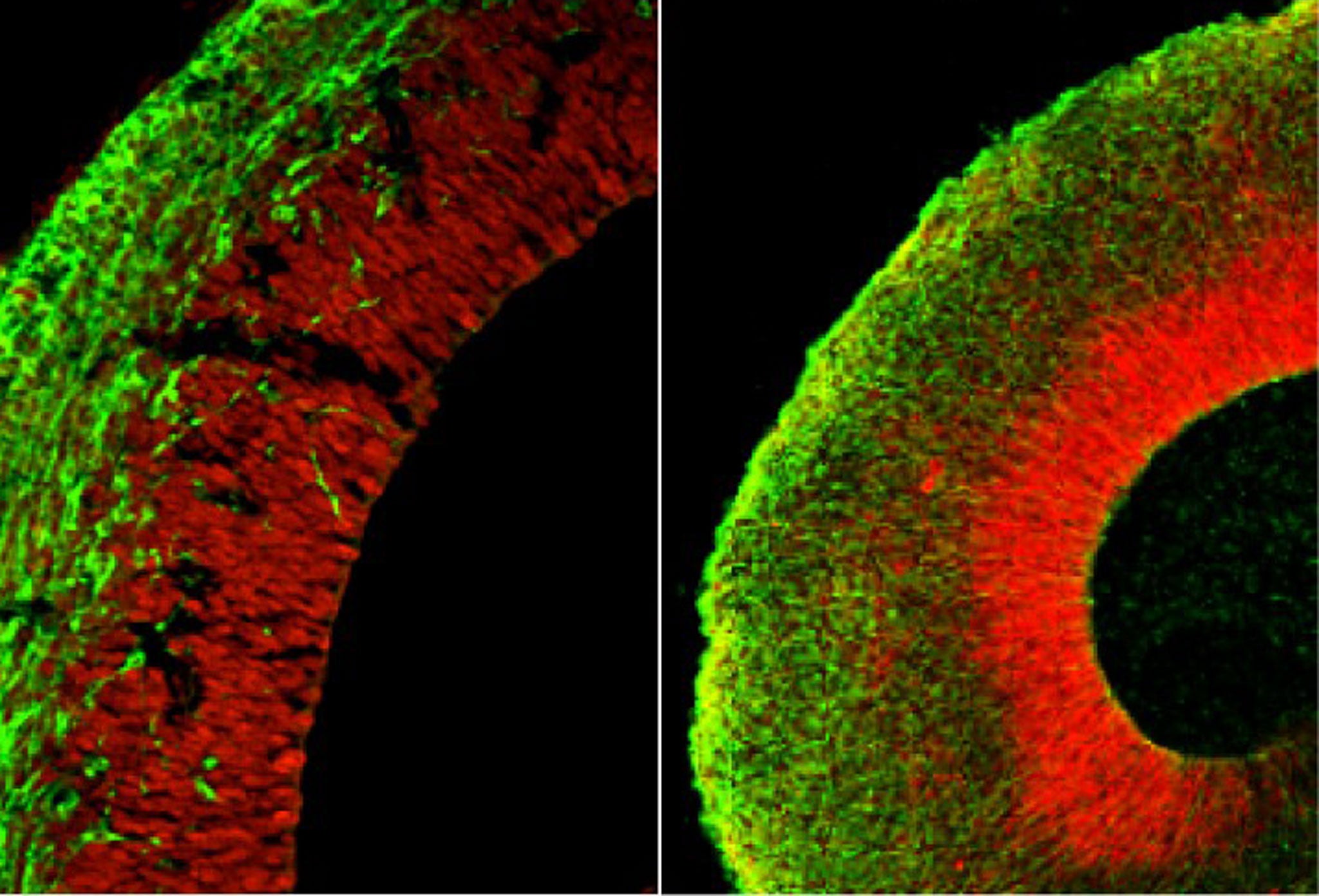 The cerebral organoid, right, compared with a section of a mouse brain, left