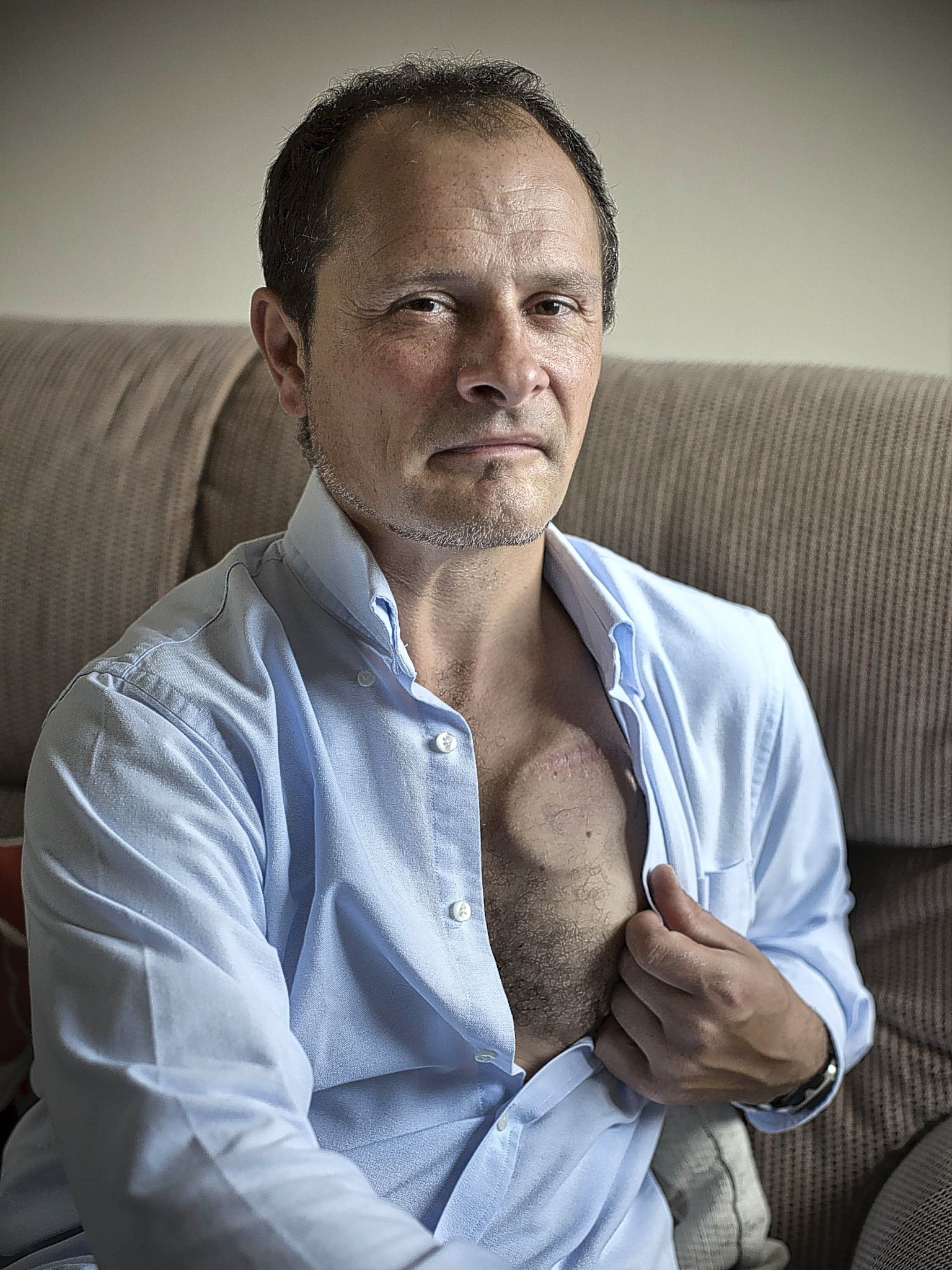 Upbeat: Matt Eagles has a brain pacemaker in his chest
