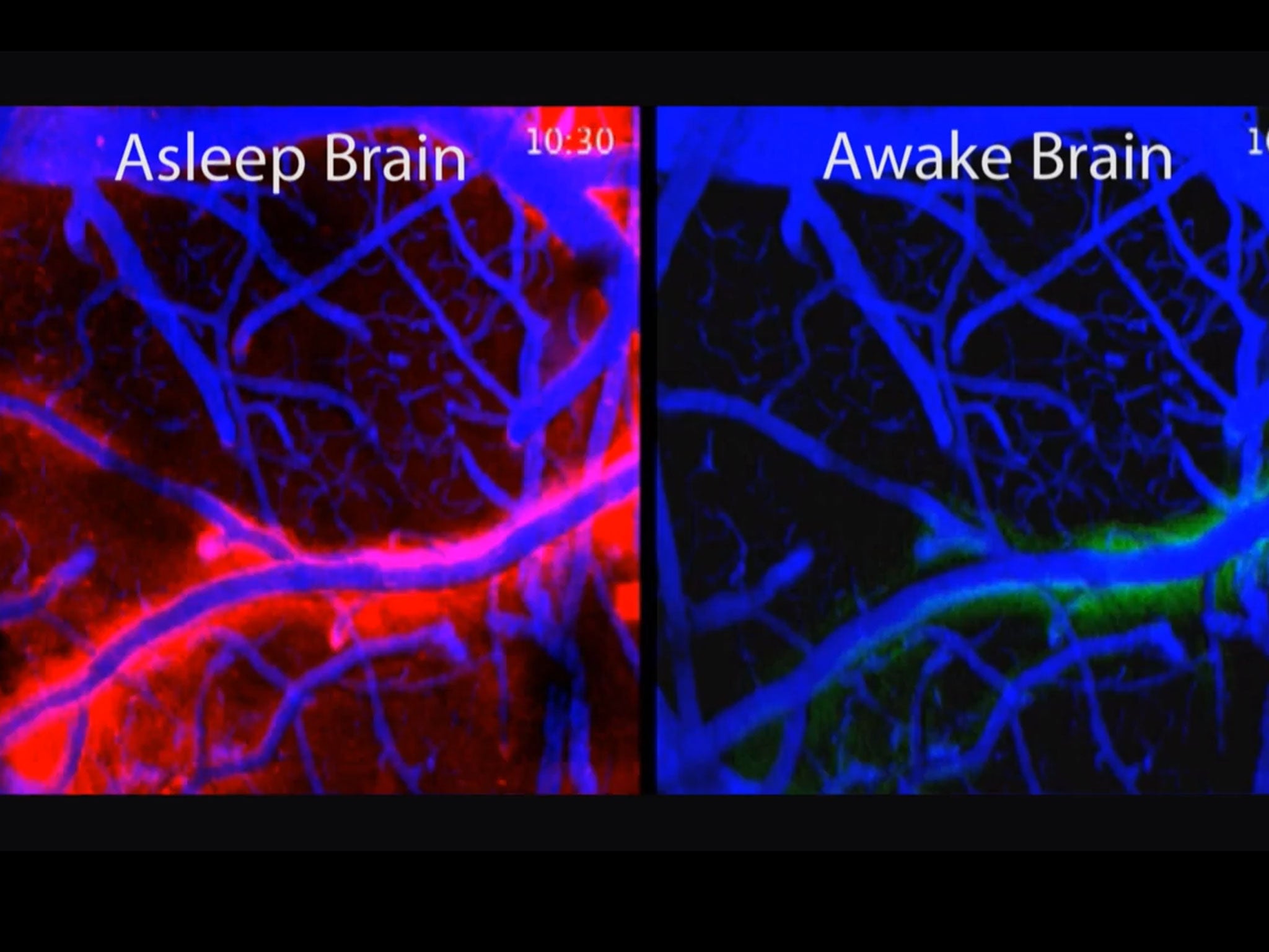 Activity in the brain is much higher in the glymphatic system when it is asleep