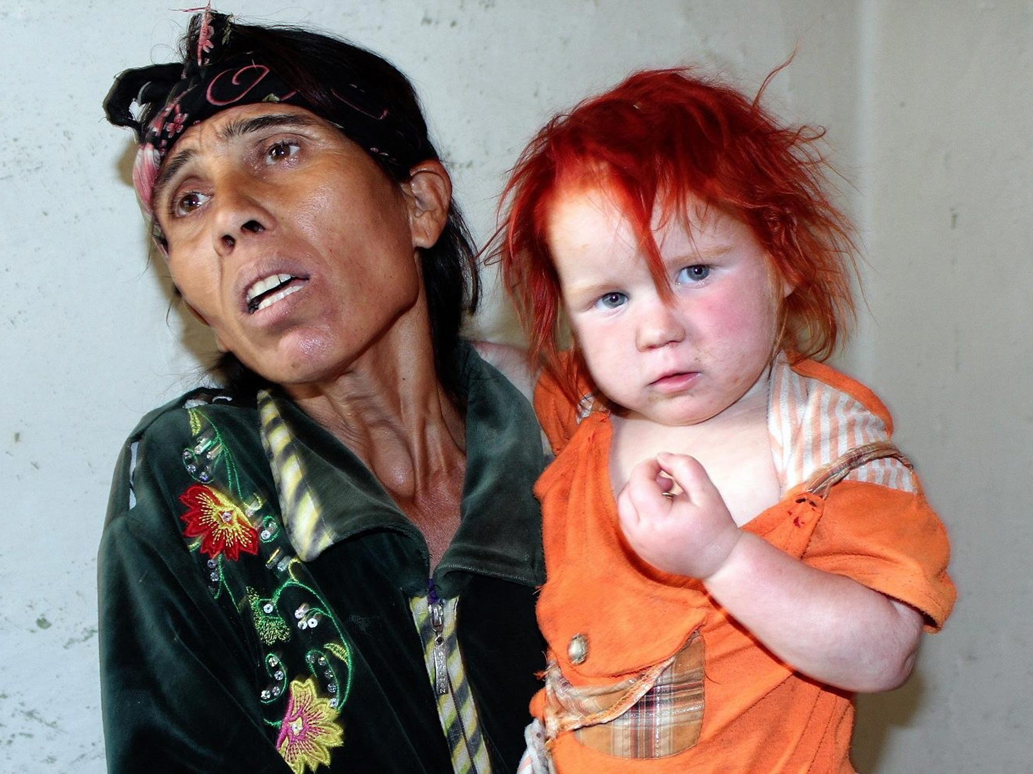 Putative mother Sasha Ruseva with one of her children, whom she claims is albino, pose for photographers in town of Nikolaevo, Bulgaria
