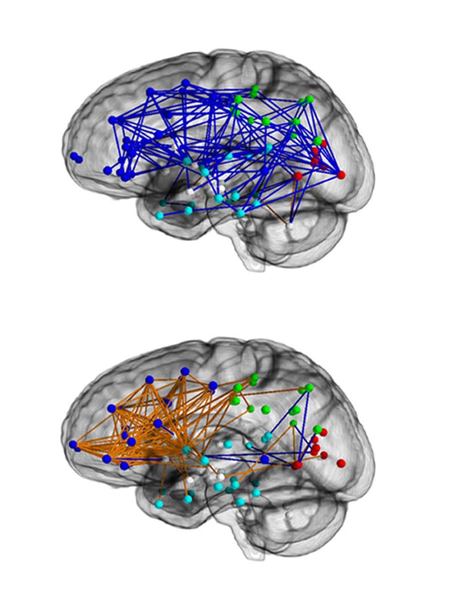 Brain networks in males (upper) and in females (lower)