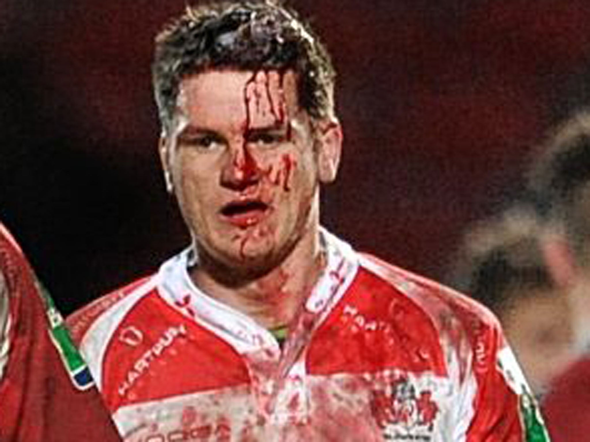 Gloucester’s Freddie Burns is left bloodied