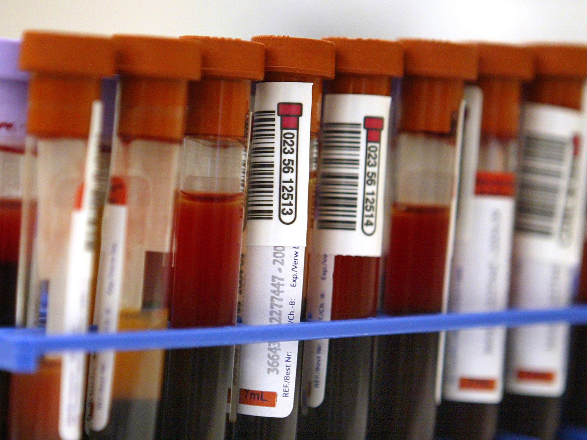 blood samples