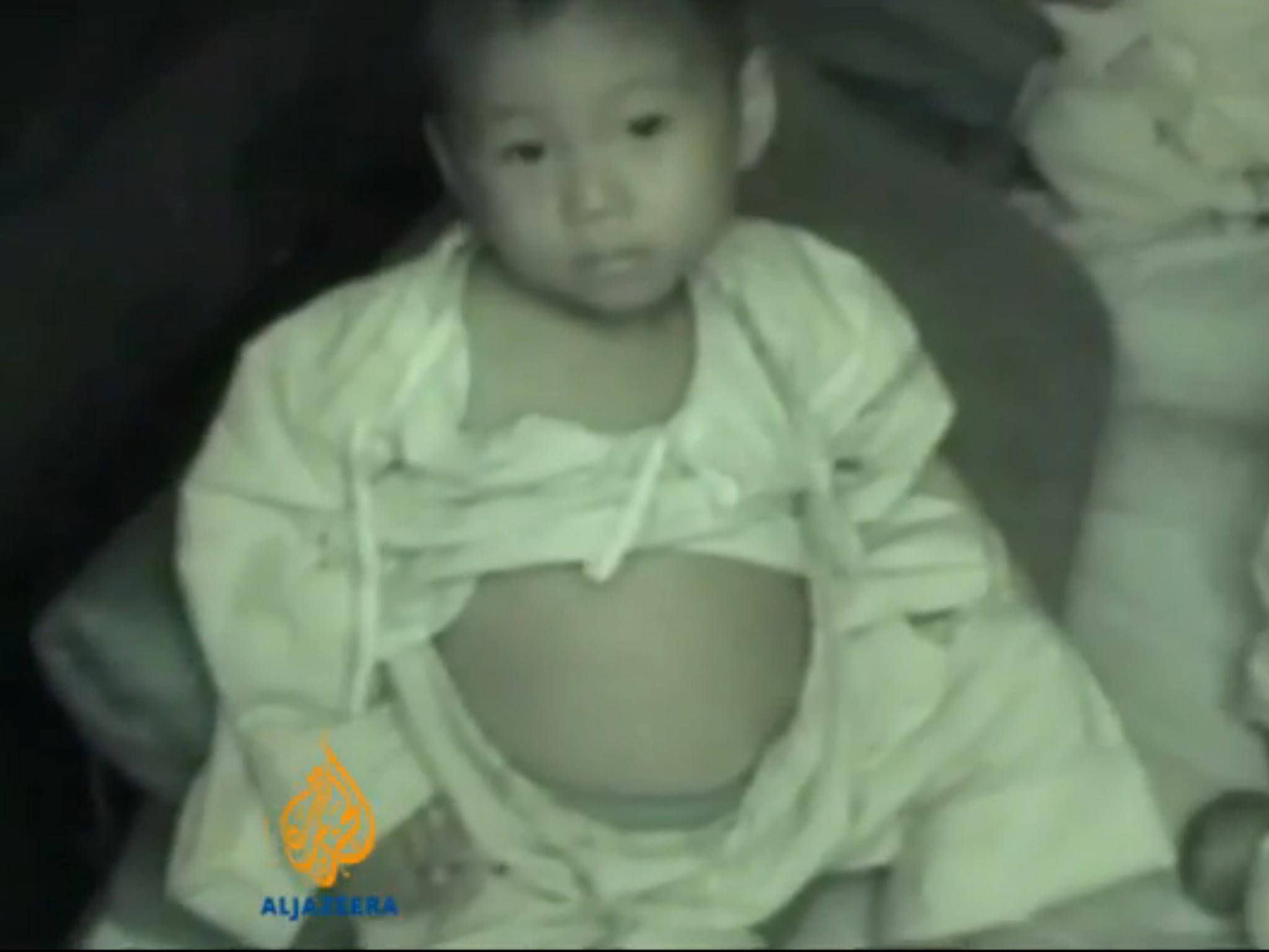 A still of a baby with a swollen stomach from a video revealing North Korea’s treatment of its citizens