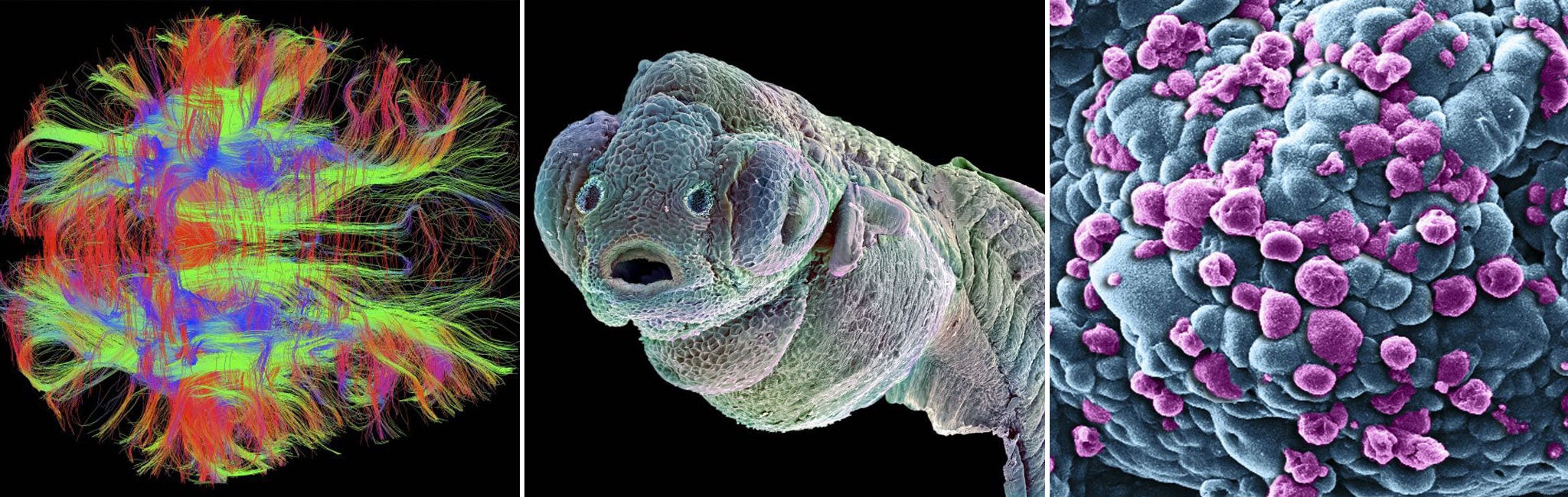 From left to right: Nerve fibres in a healthy adult human; Zebrafish embryo; Breast cancer cells