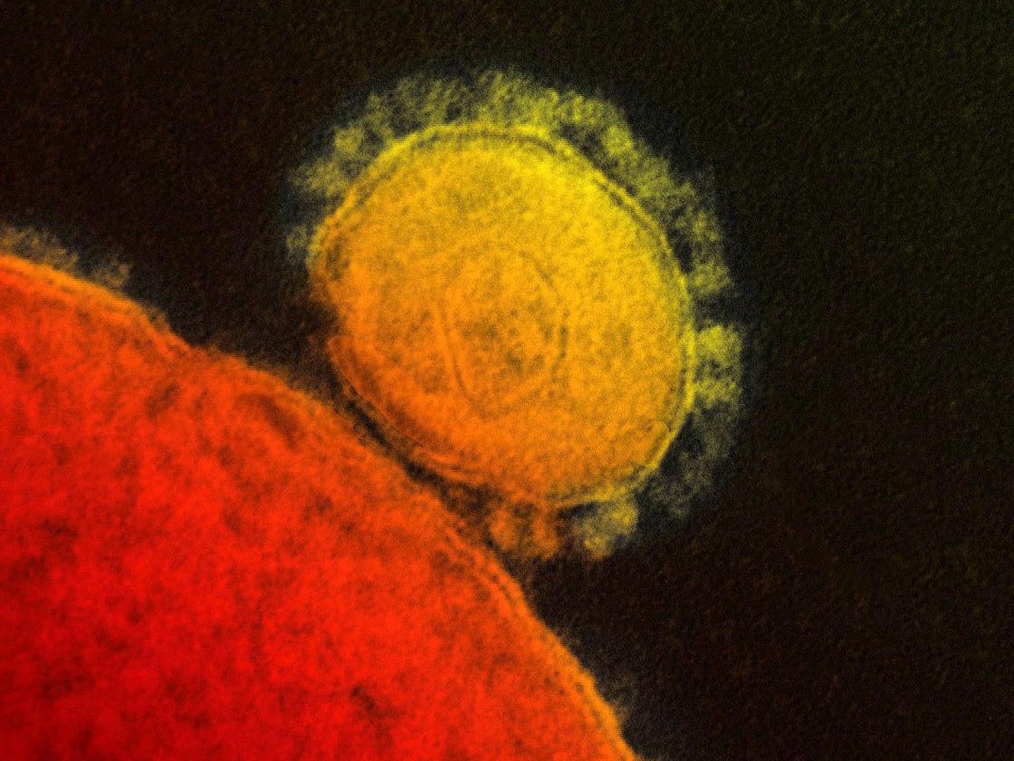 Public Health England (PHE) said the non-UK national was diagnosed with Middle East Respiratory Syndrome coronavirus (MERS-CoV) today